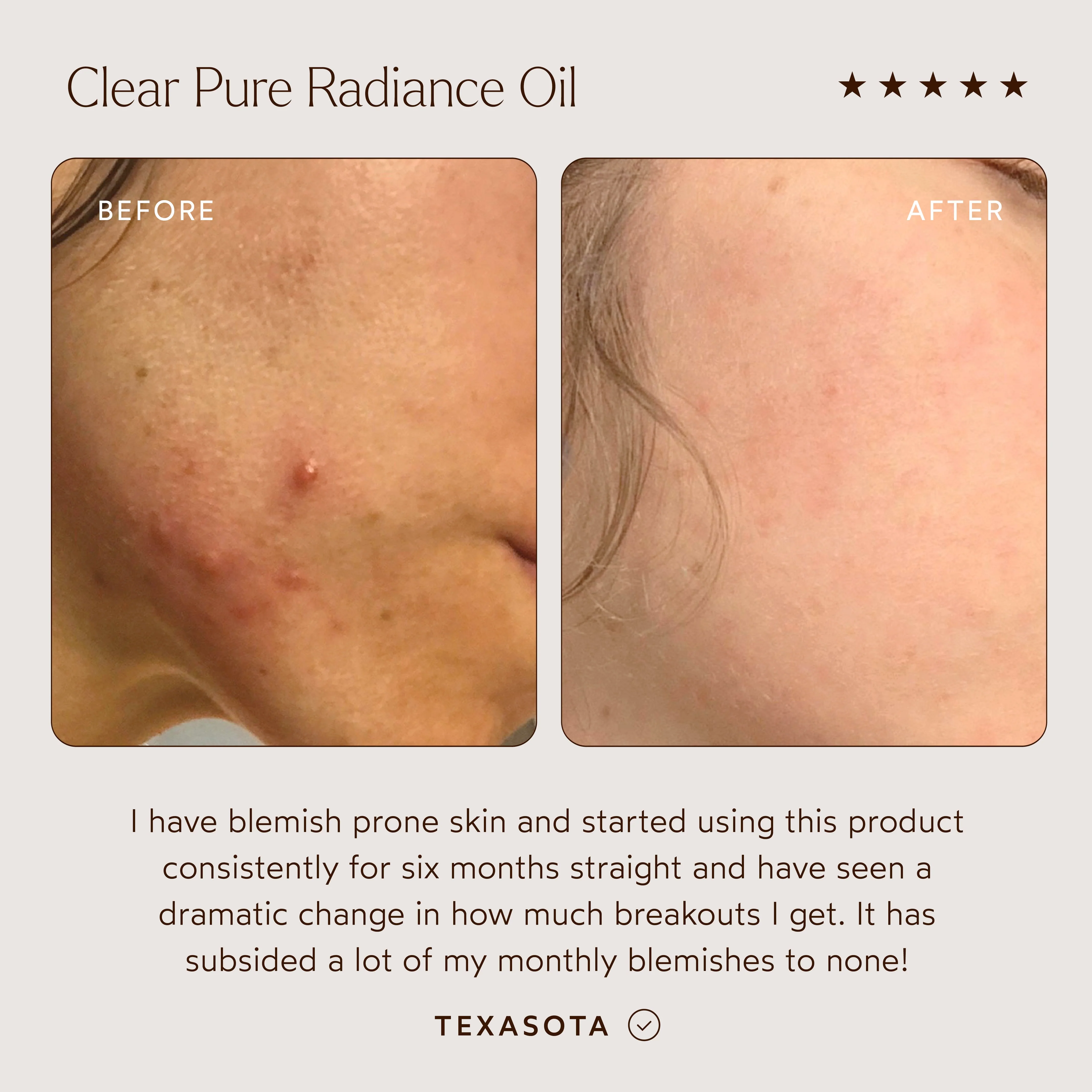 CLEAR Pure Radiance Oil - Image 3