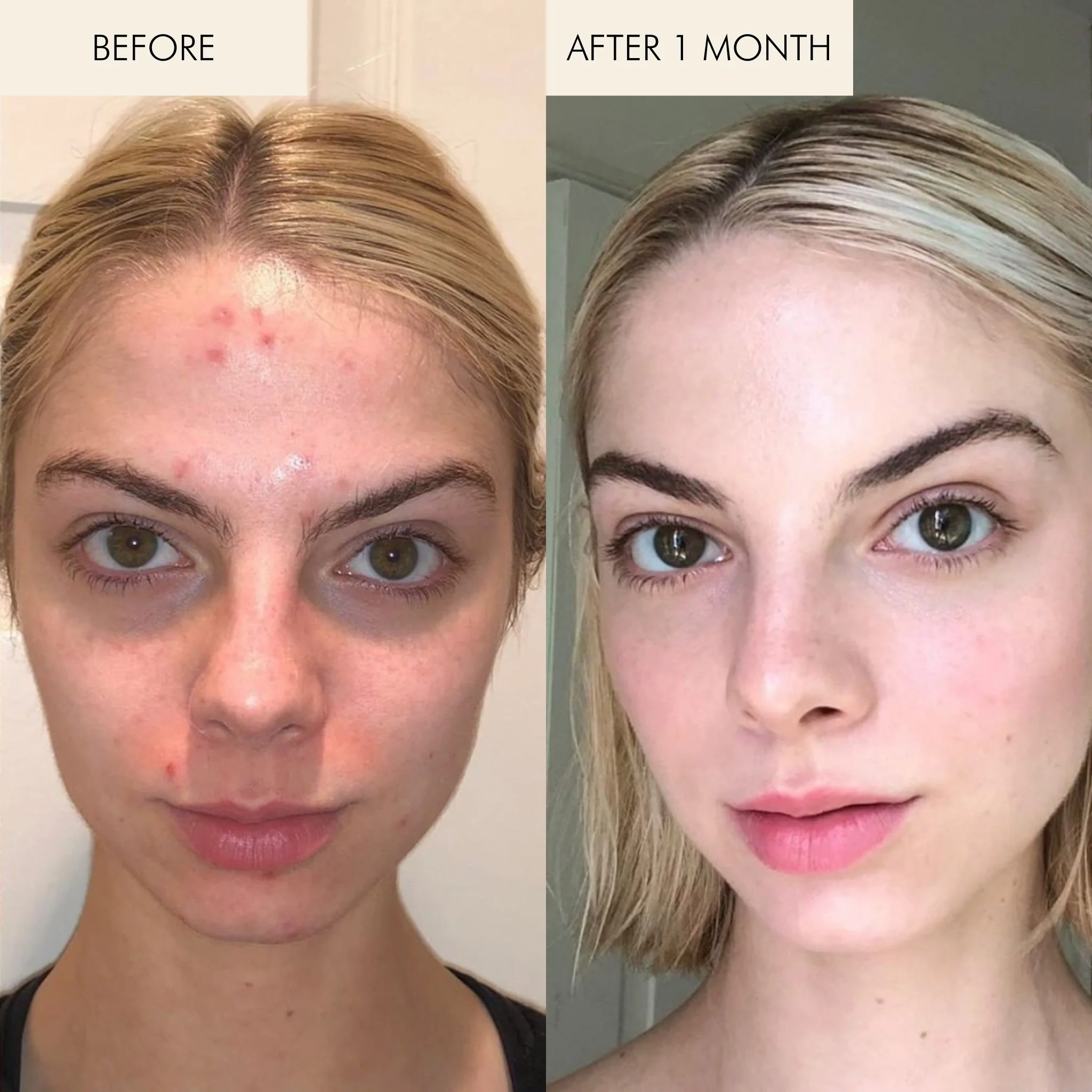 Evening Primrose + Green Tea Algae Retinol Face Oil - Image 5