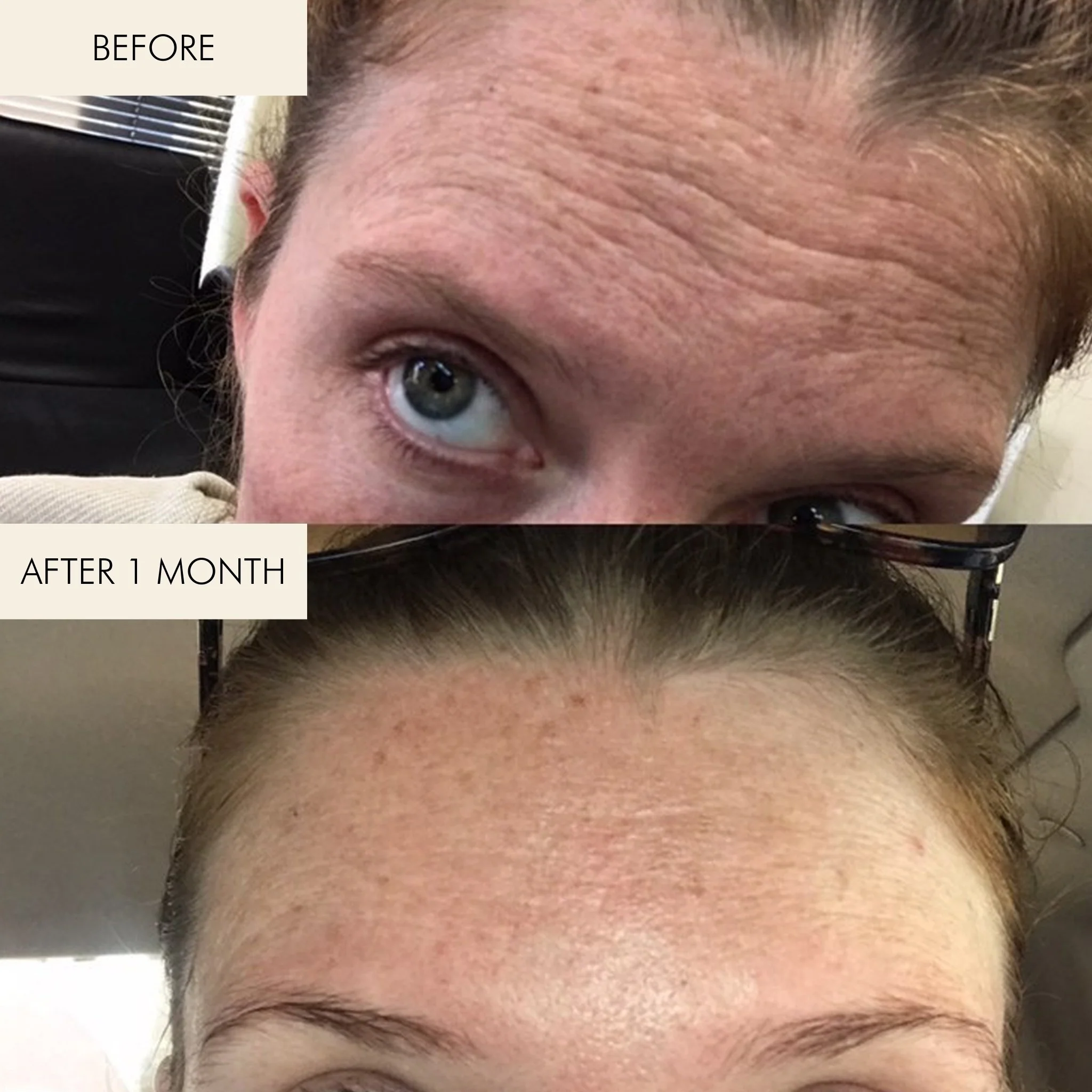 Evening Primrose + Green Tea Algae Retinol Face Oil - Image 6