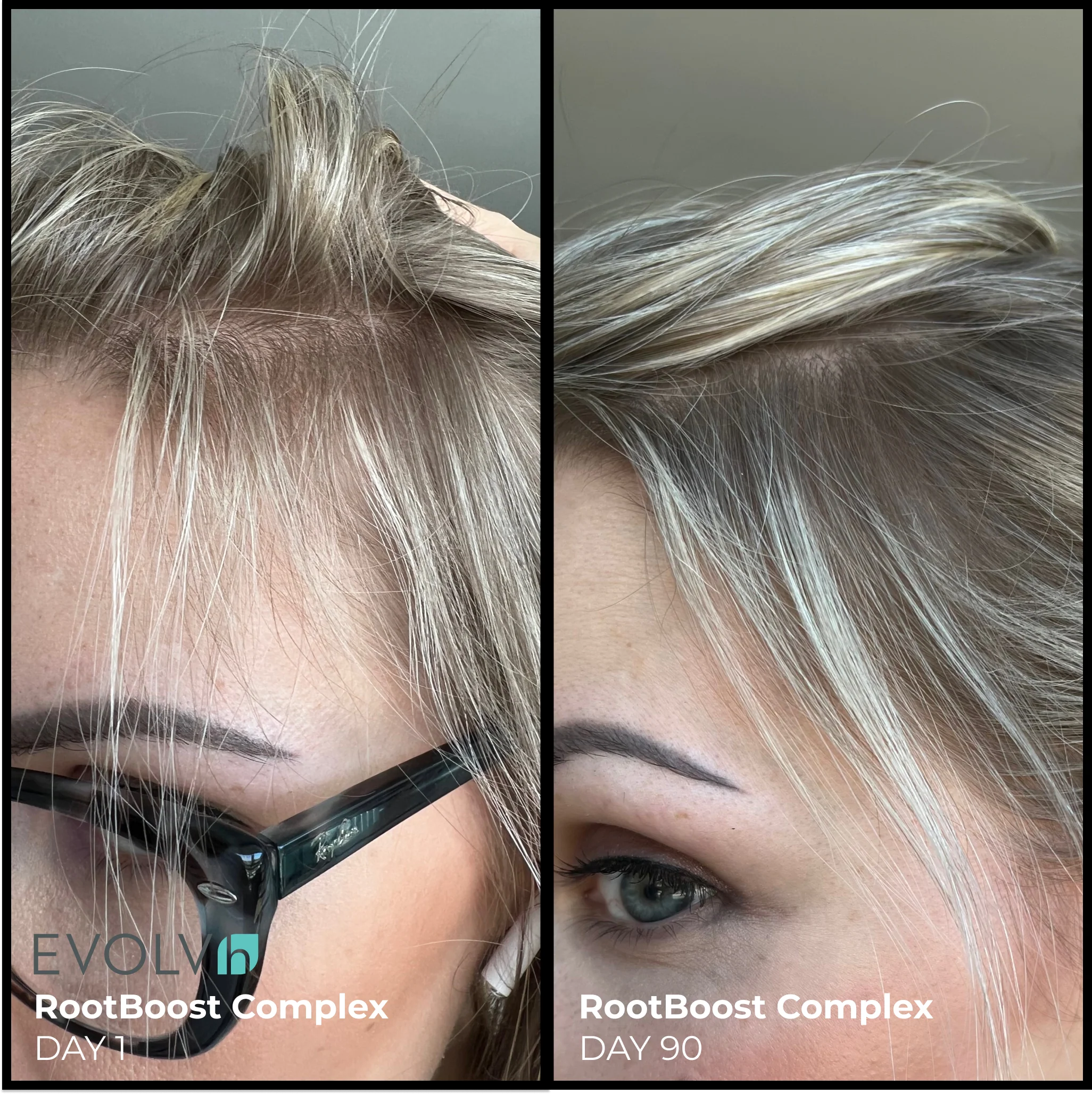 Better Roots RootBoost Complex - Image 6