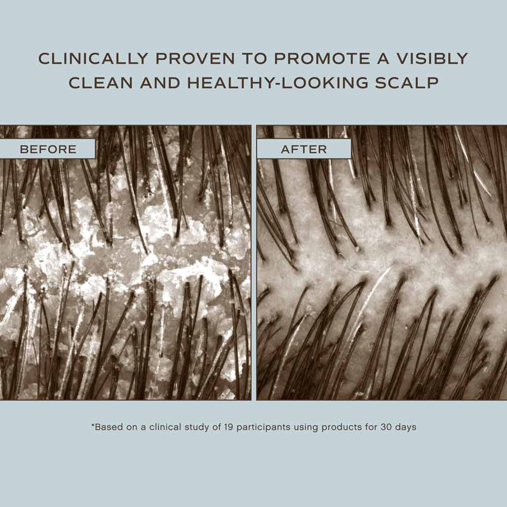 Hair Renew Scalp Hairbath - Image 6