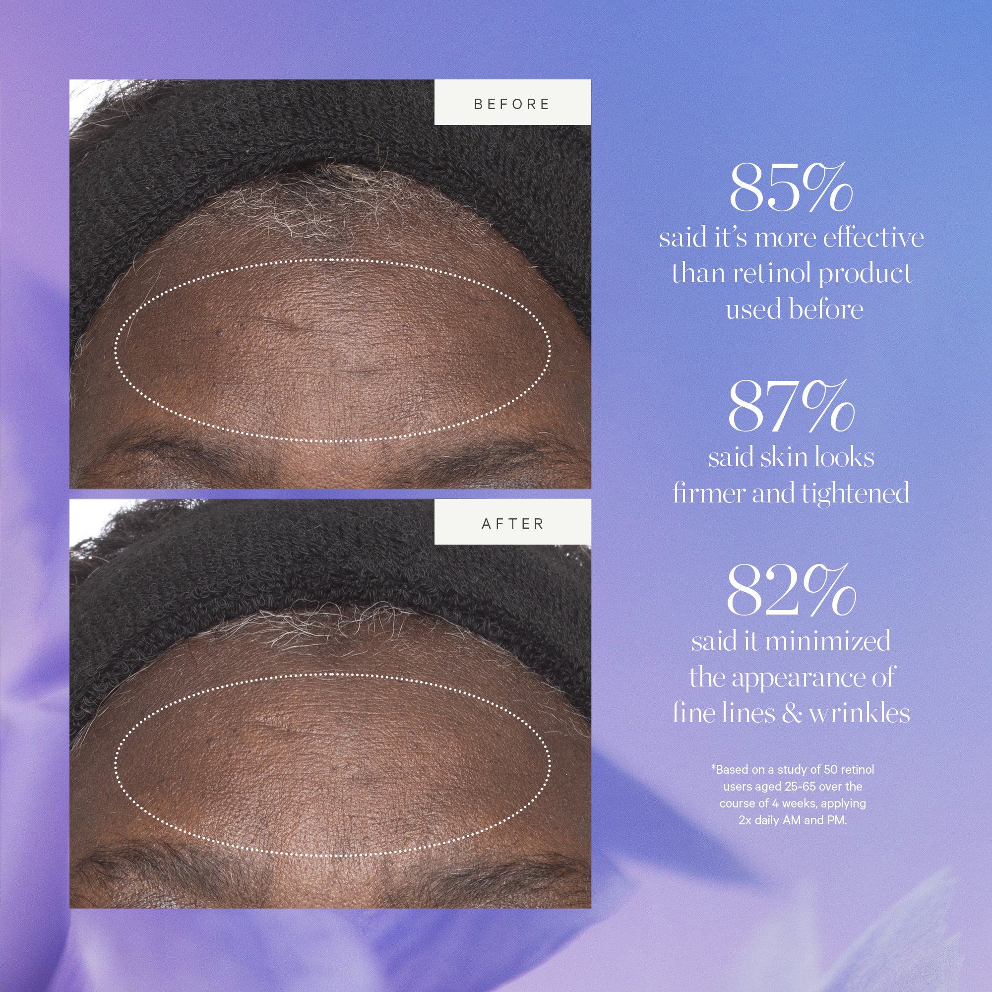 Plant Stem Cell Retinol Alternative Moisturizer - Image 5