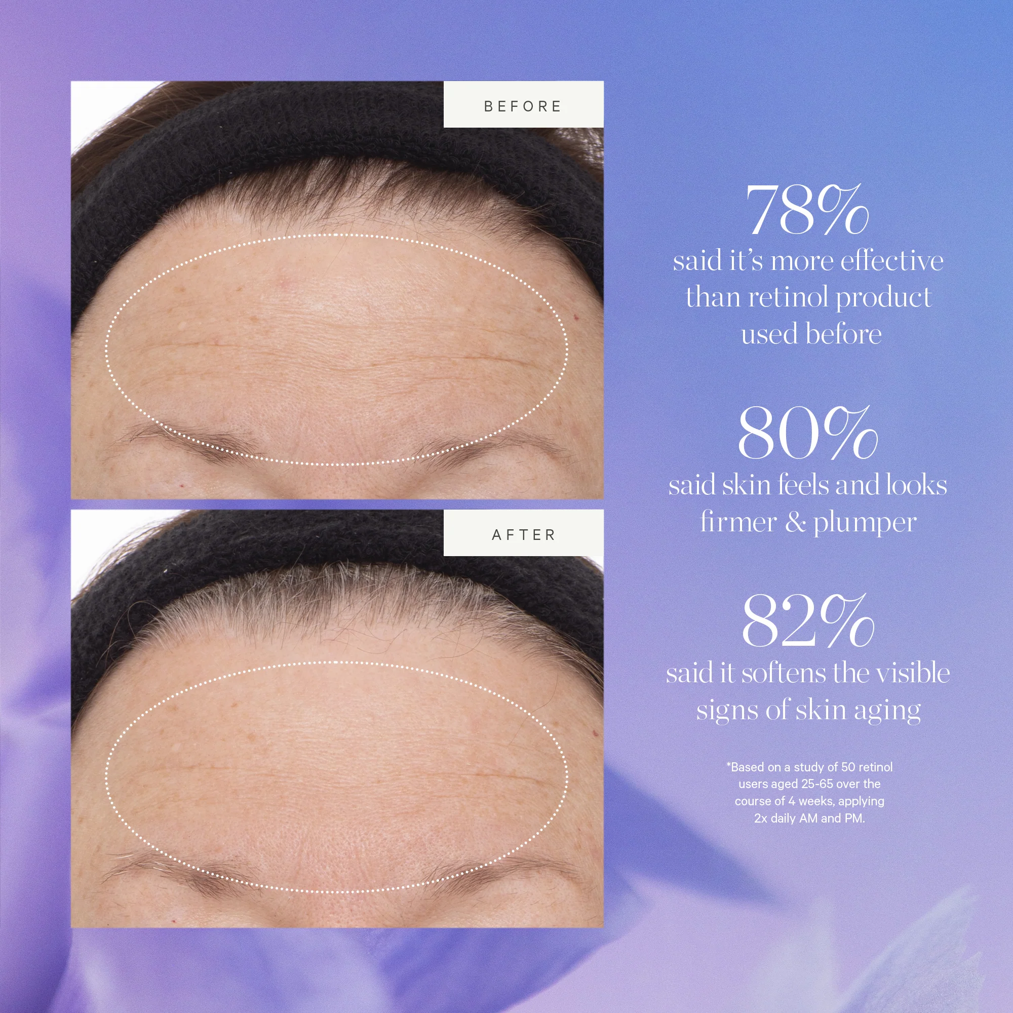 Plant Stem Cell Retinol Alternative Serum - Image 5