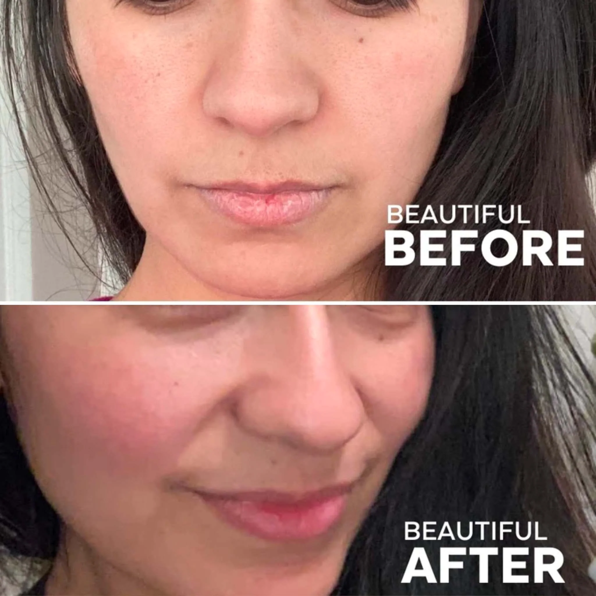 Lip Treatment Kit - Image 5