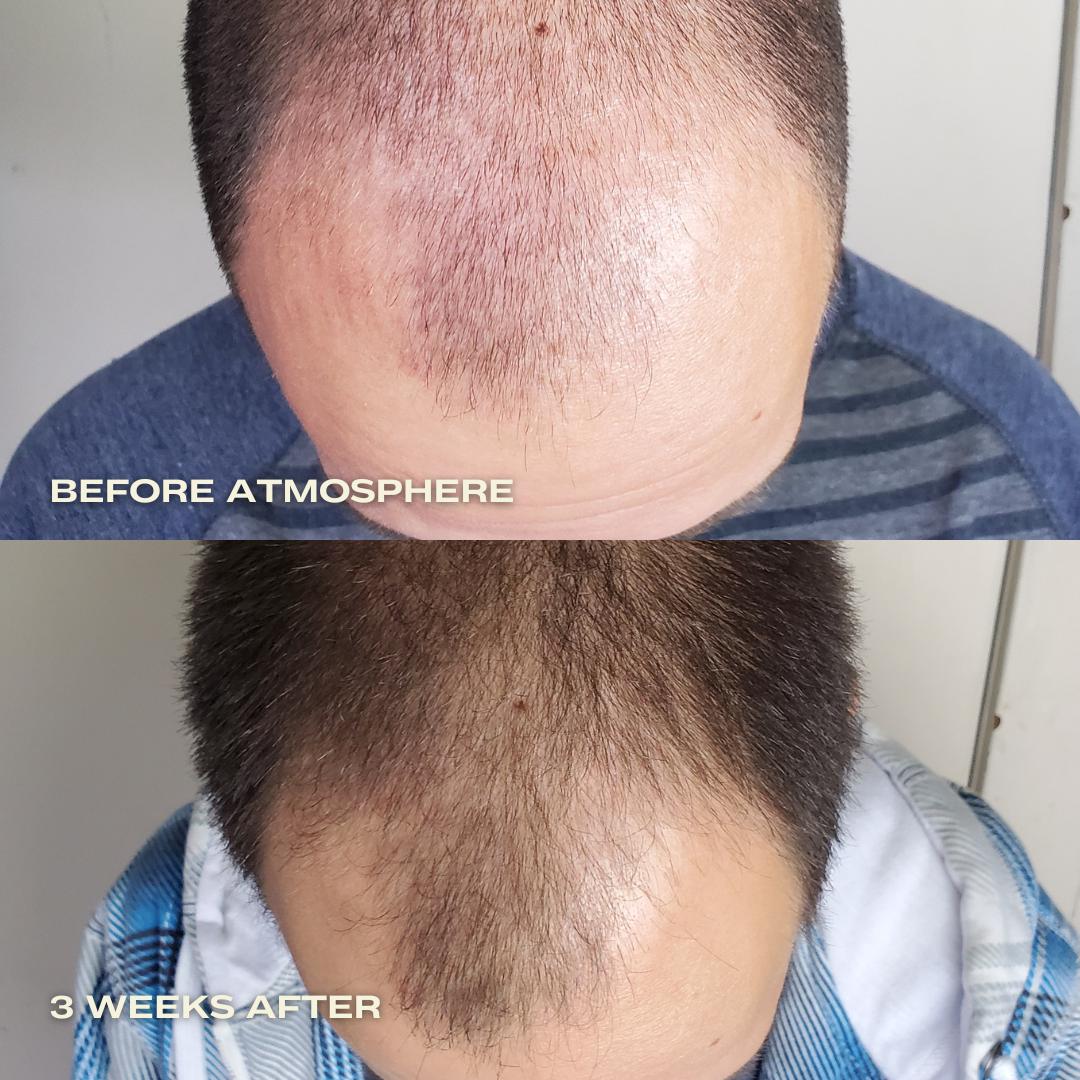 Atmosphere Hair Density & Scalp Serum - Image 4