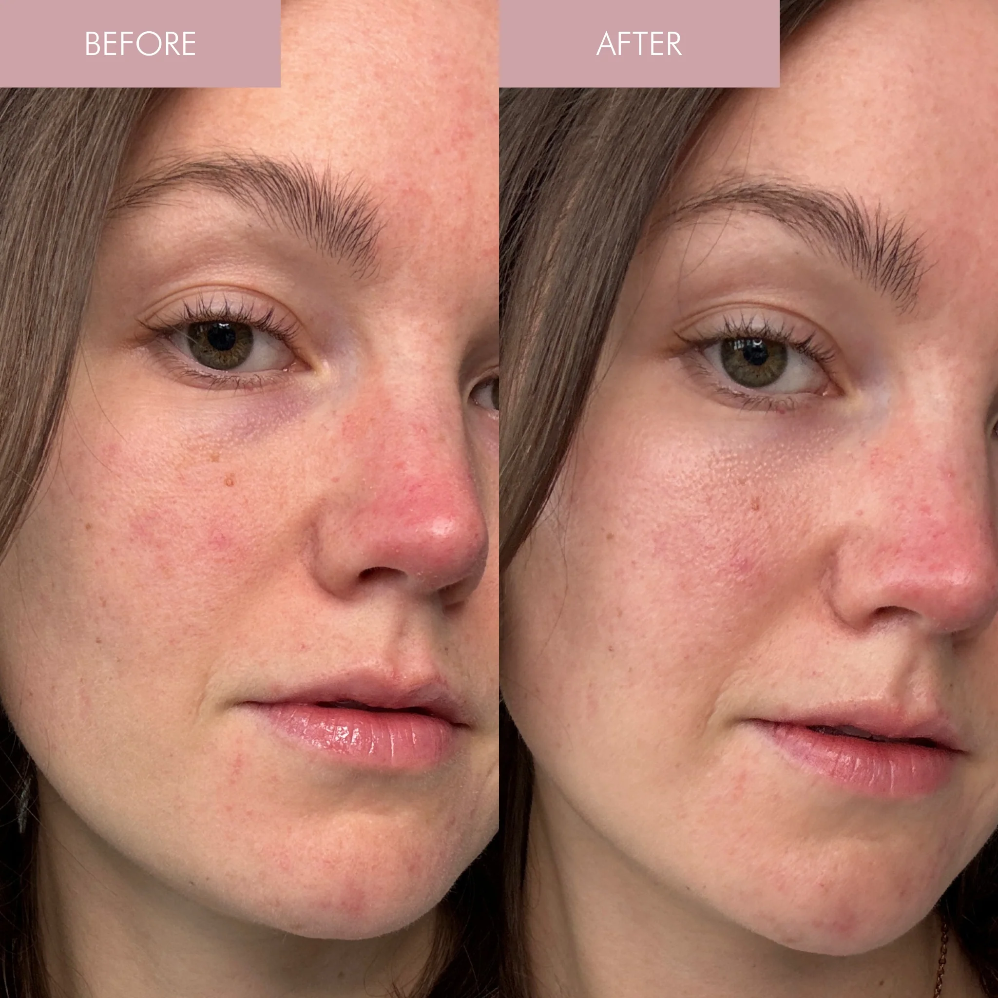 Pearl Peptide Glaze Facial Essence - Image 6