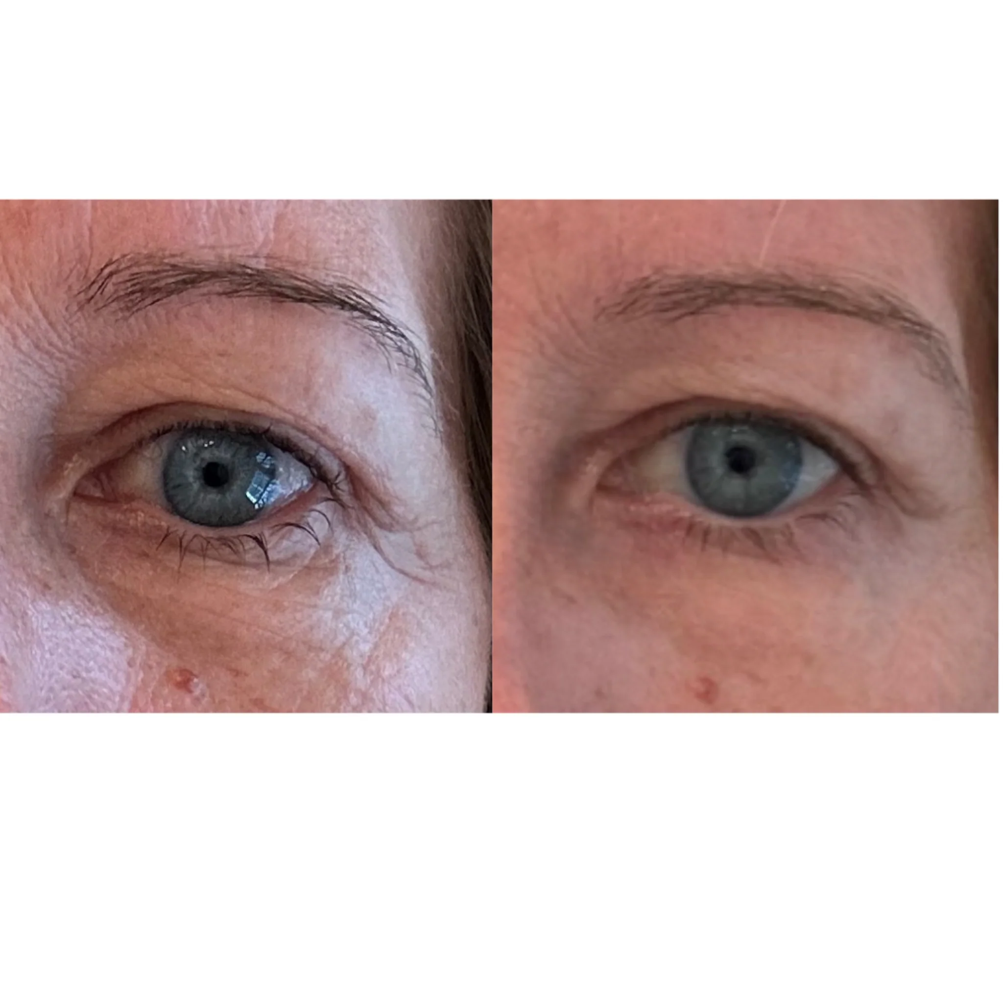 The Advanced Eye Response Complex - Image 6