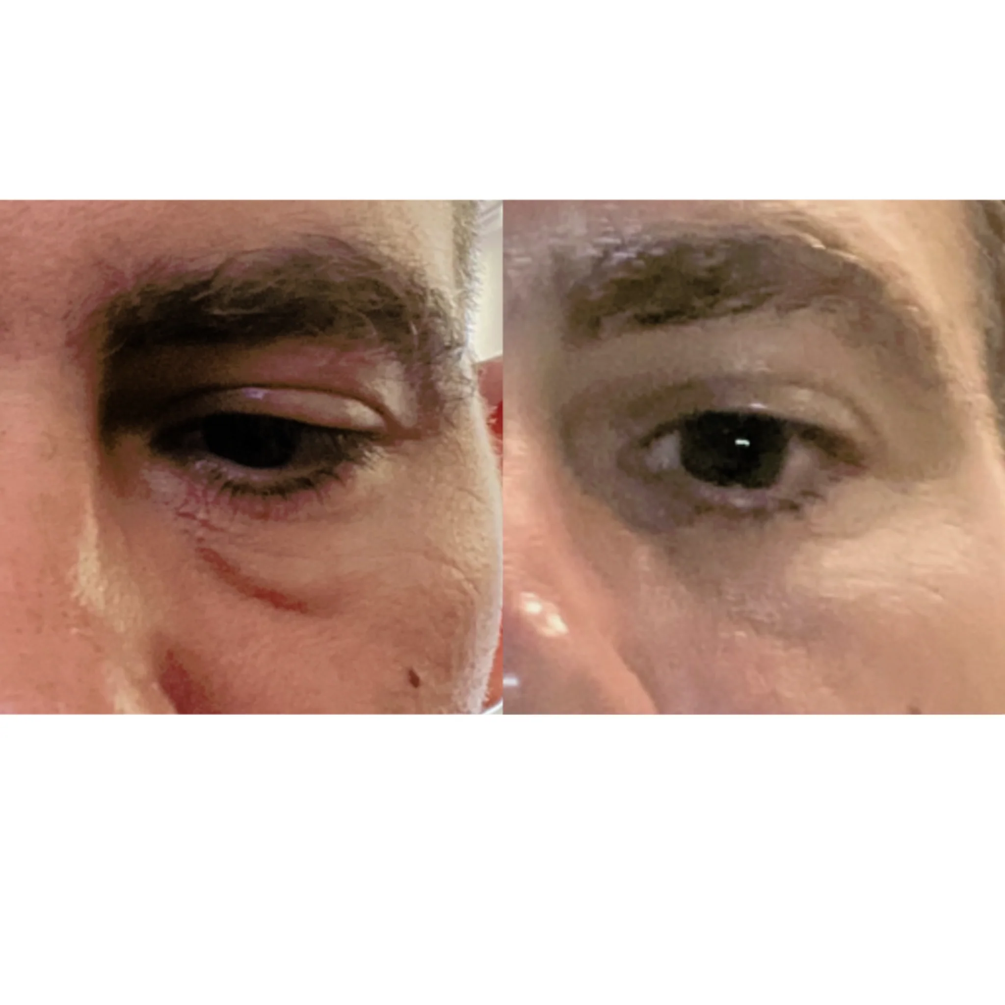The Advanced Eye Response Complex - Image 7