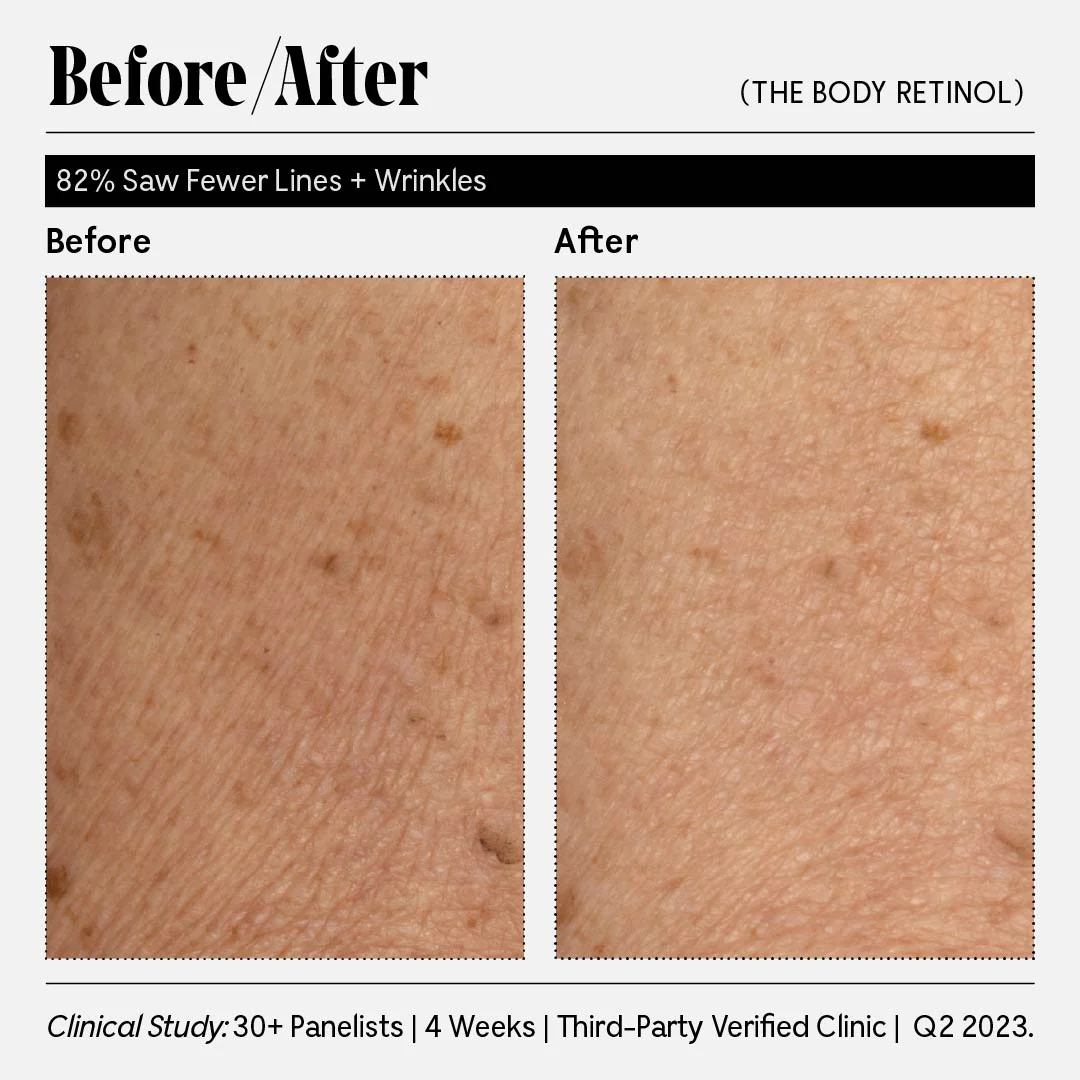 The Body Retinol - Image 11