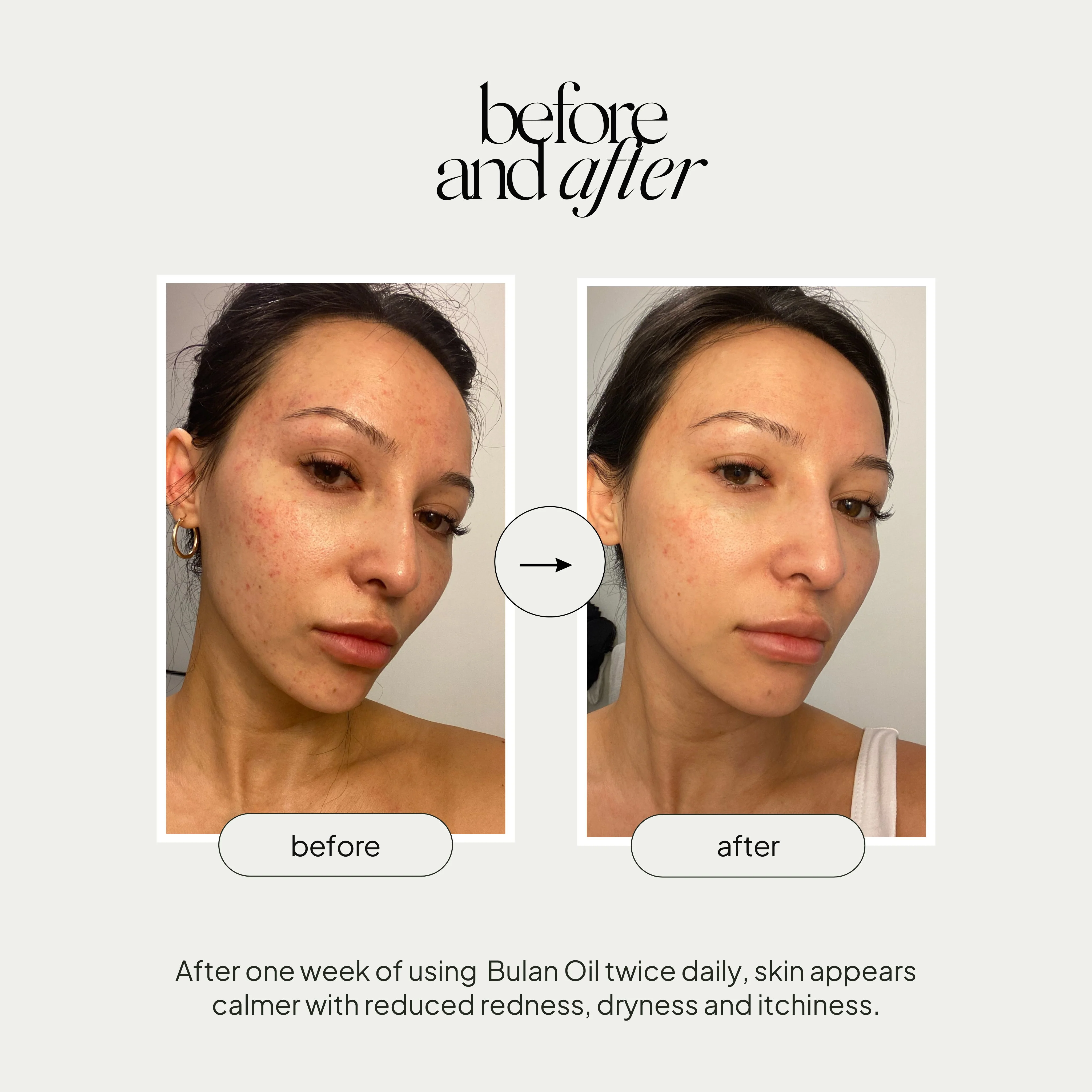 Bulan Nourishing Facial Oil - Image 5
