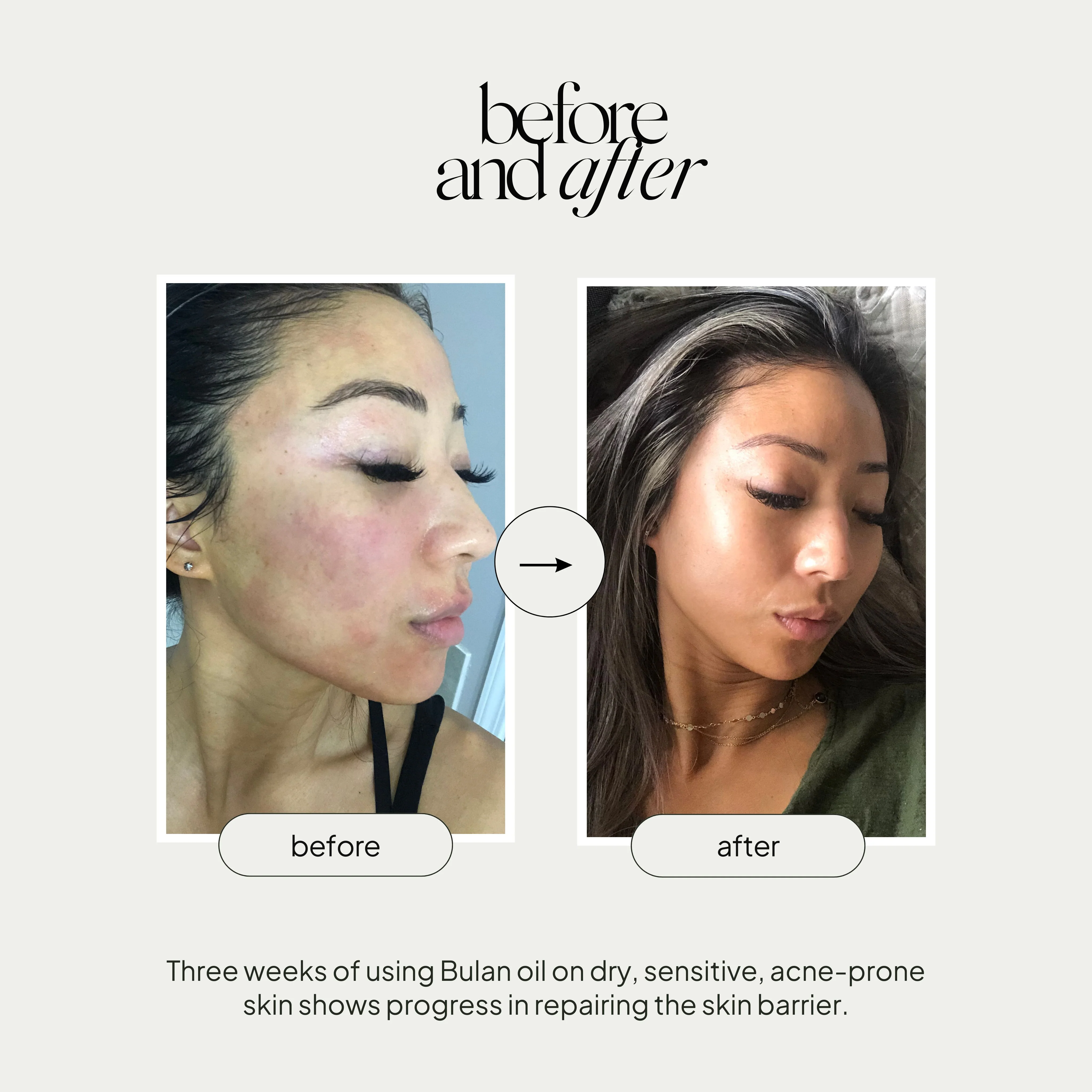 Bulan Nourishing Facial Oil - Image 6