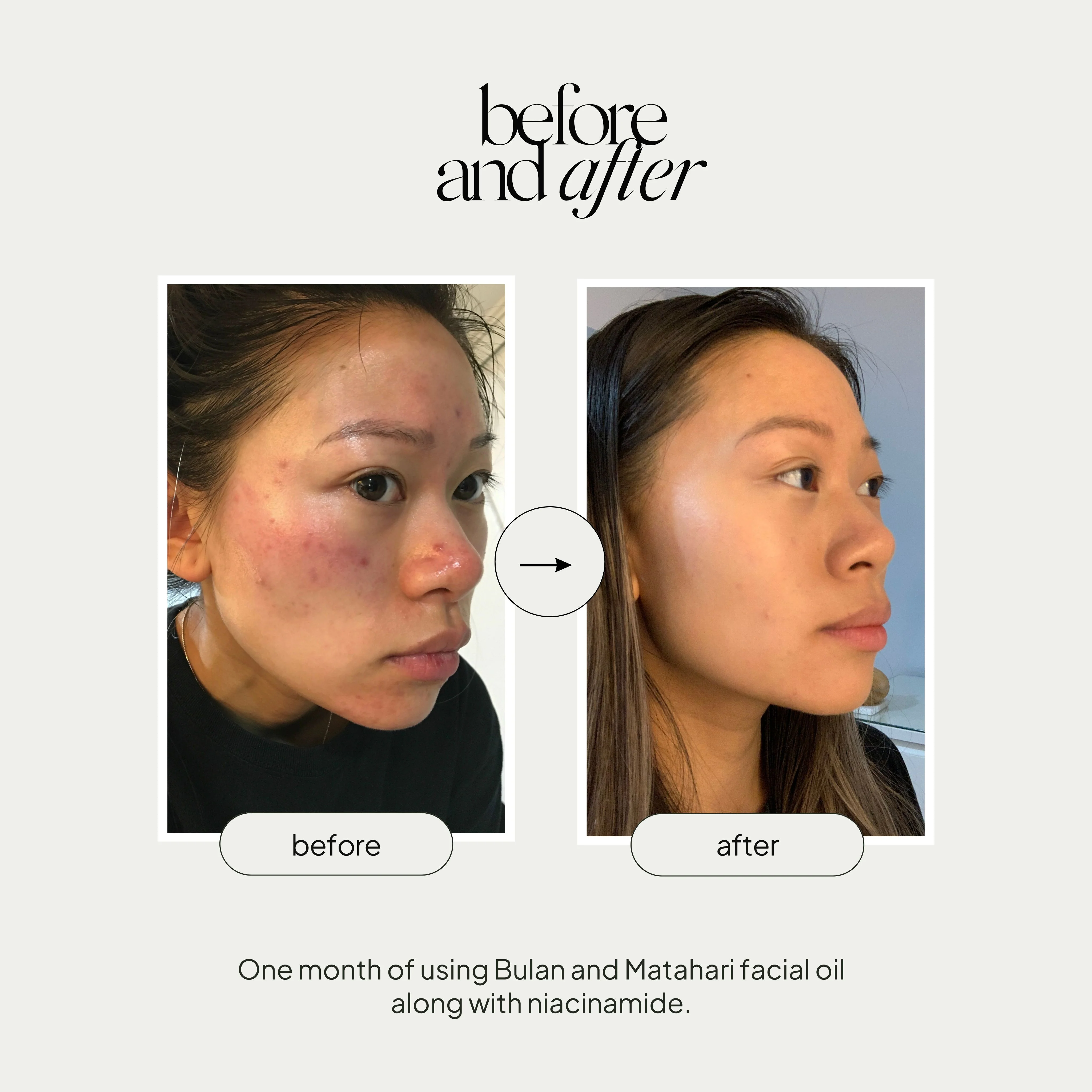 Mini Facial Oil Duo Set - Image 5
