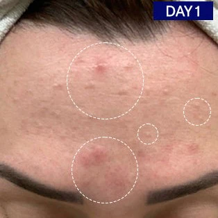 Salicylic + Hyaluronic Acid Clarifying Serum - Image 4