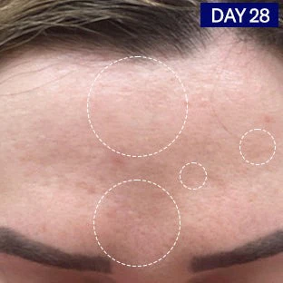 Salicylic + Hyaluronic Acid Clarifying Serum - Image 5