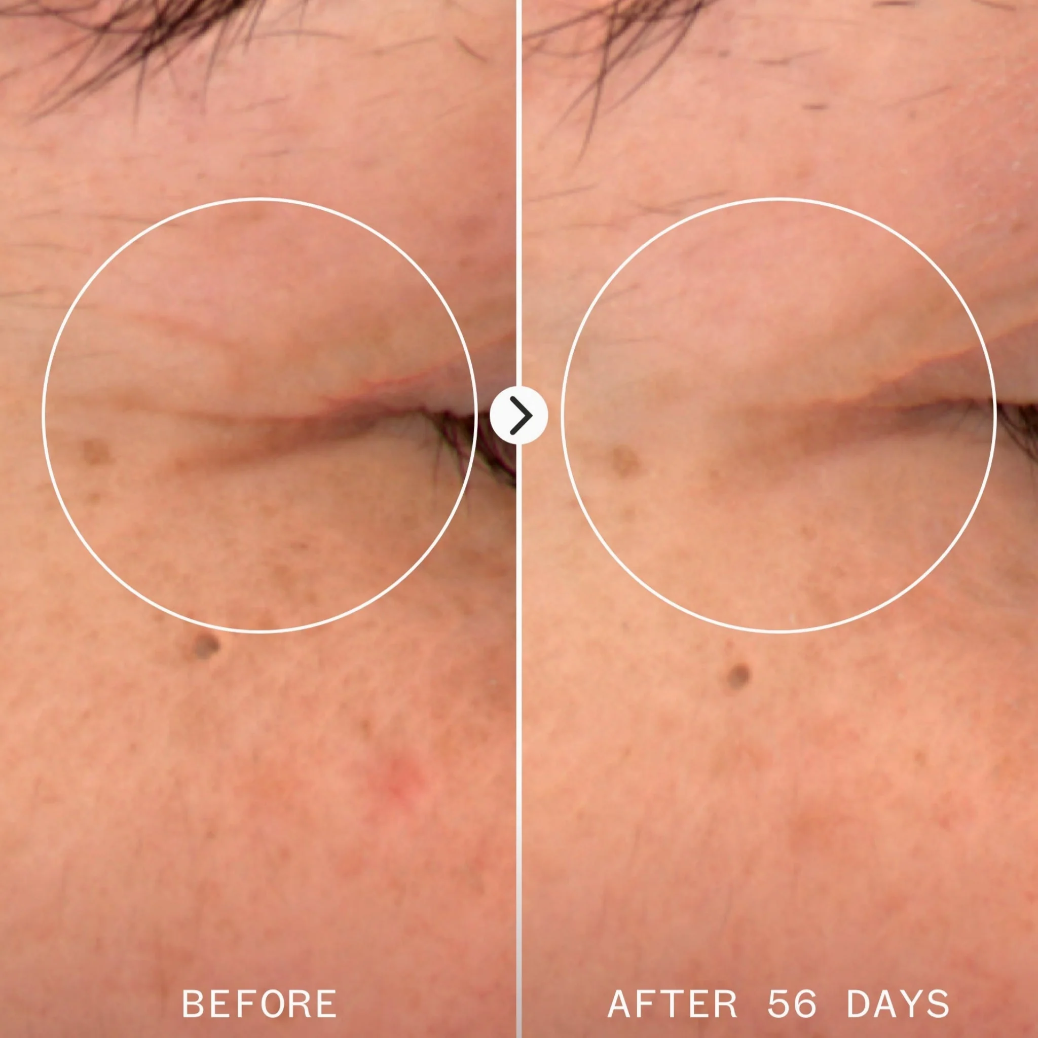 Age Confidence Nad & Tri Peptide Renewal Serum - Image 7