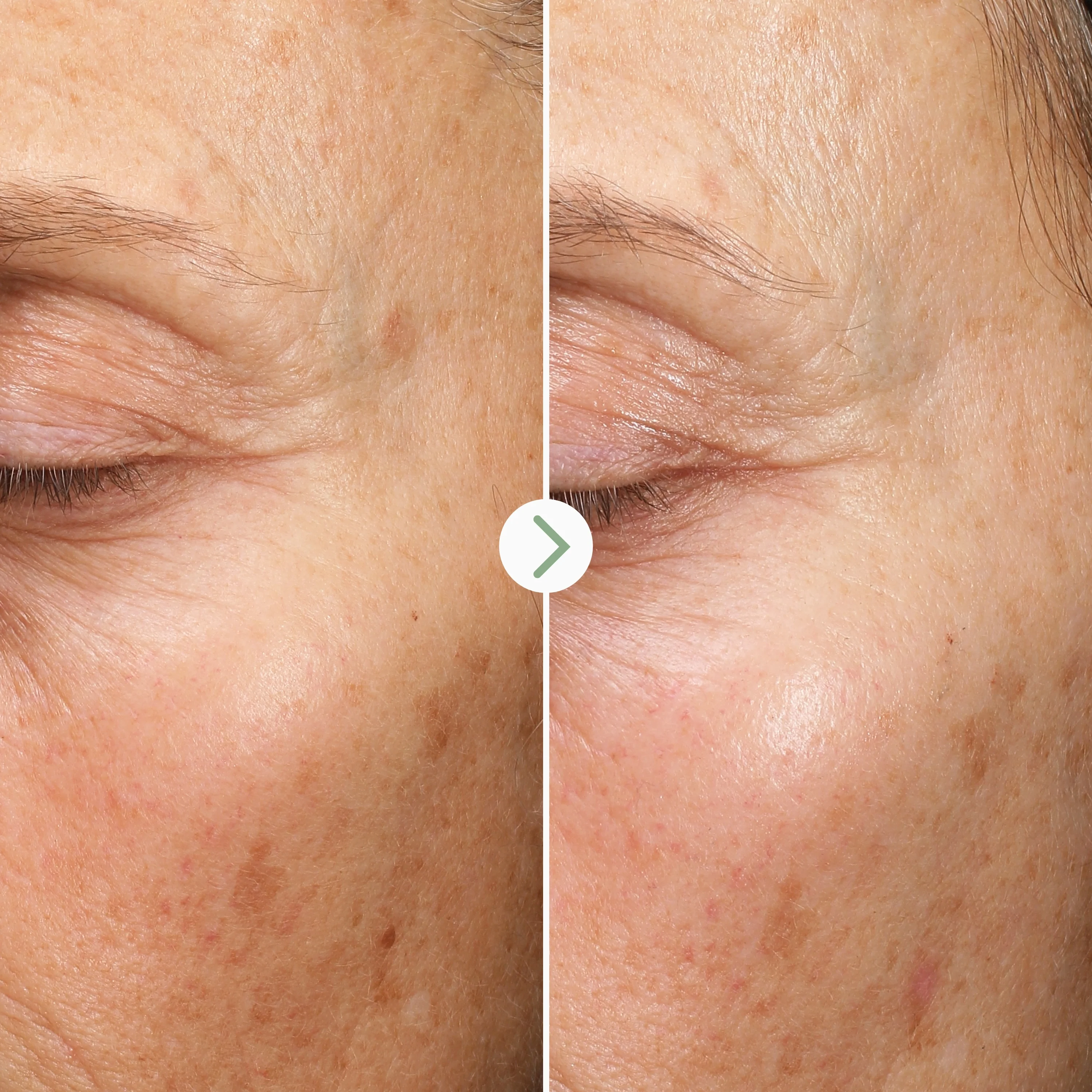 Fade Forward Dark Spot Serum - Image 5
