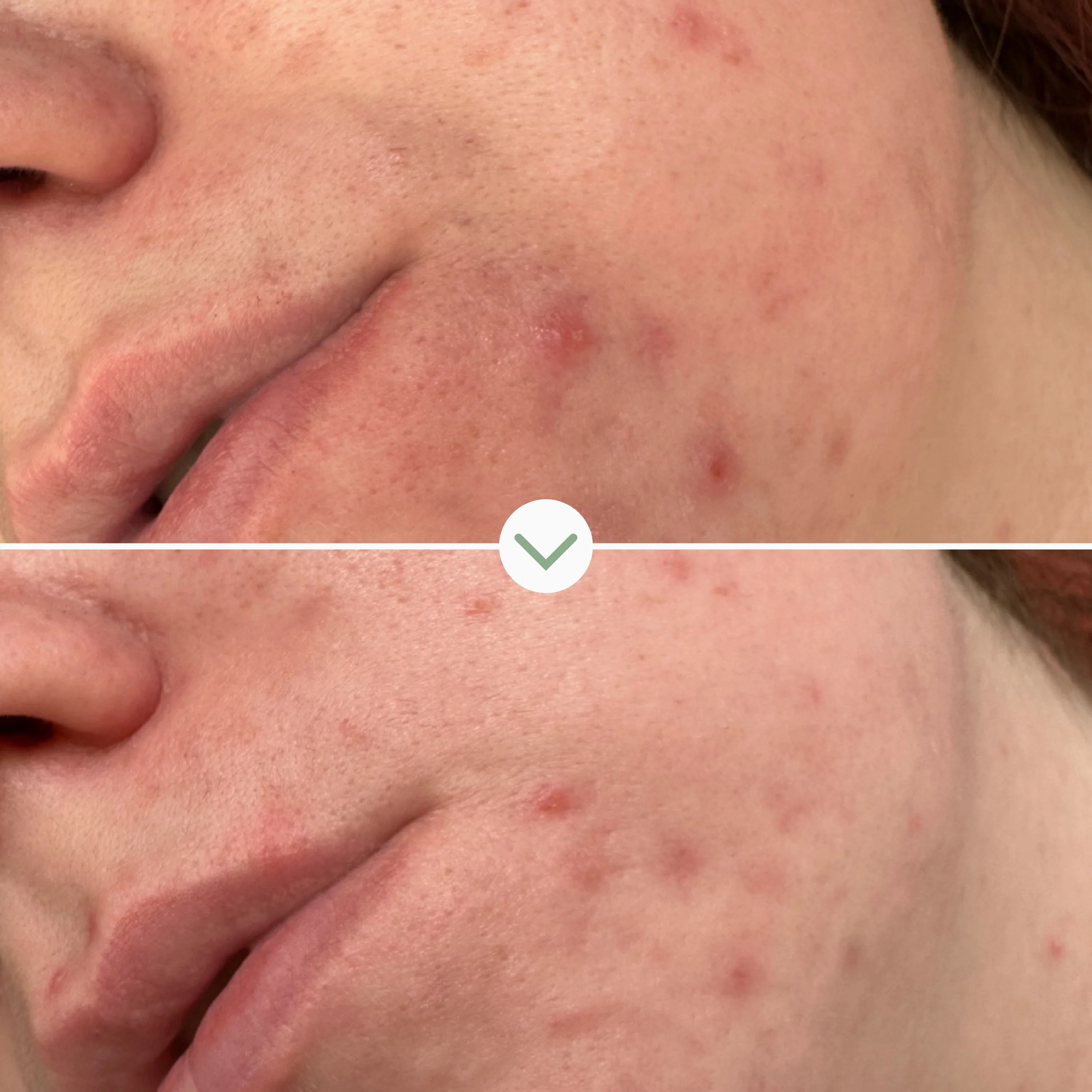 Phaze Rebalance Cleanser - Image 5
