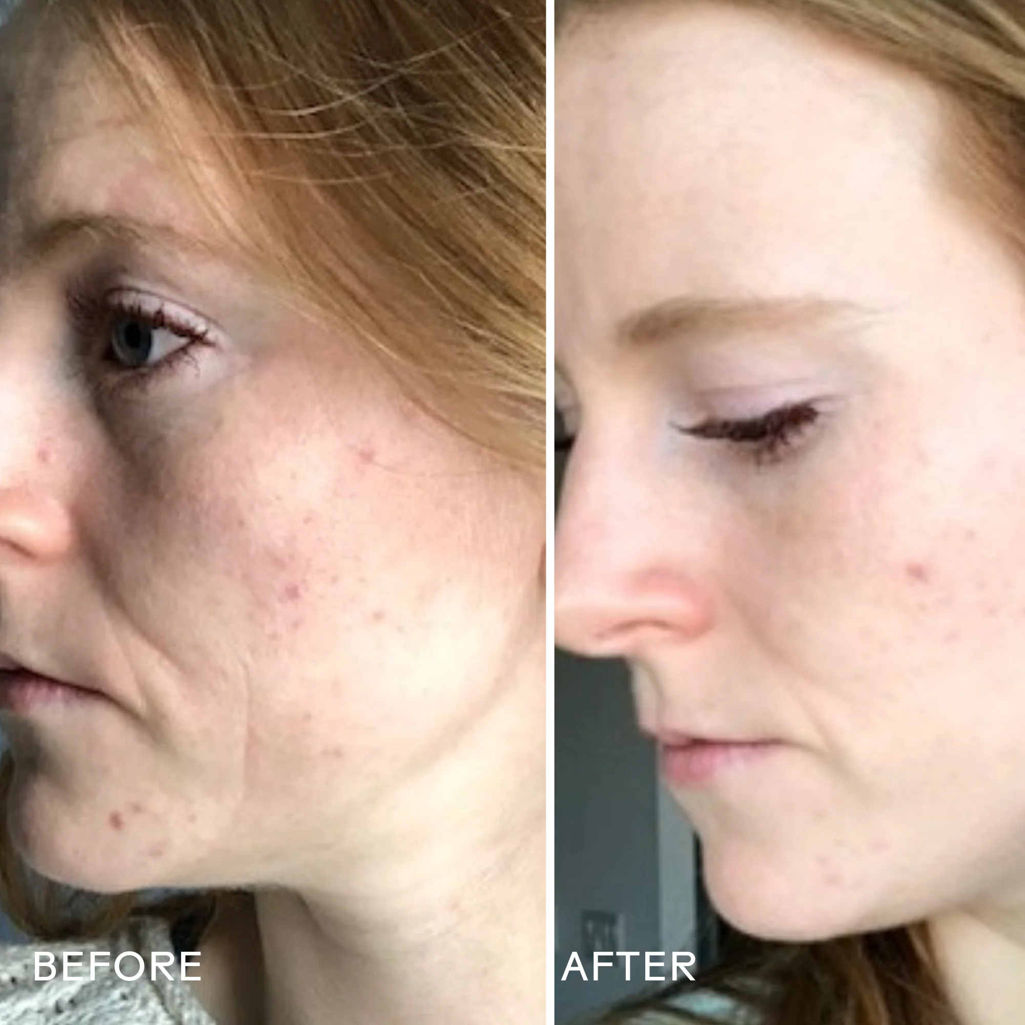 Refresh Papaya + Salicylic Acid Cleanser - Image 4