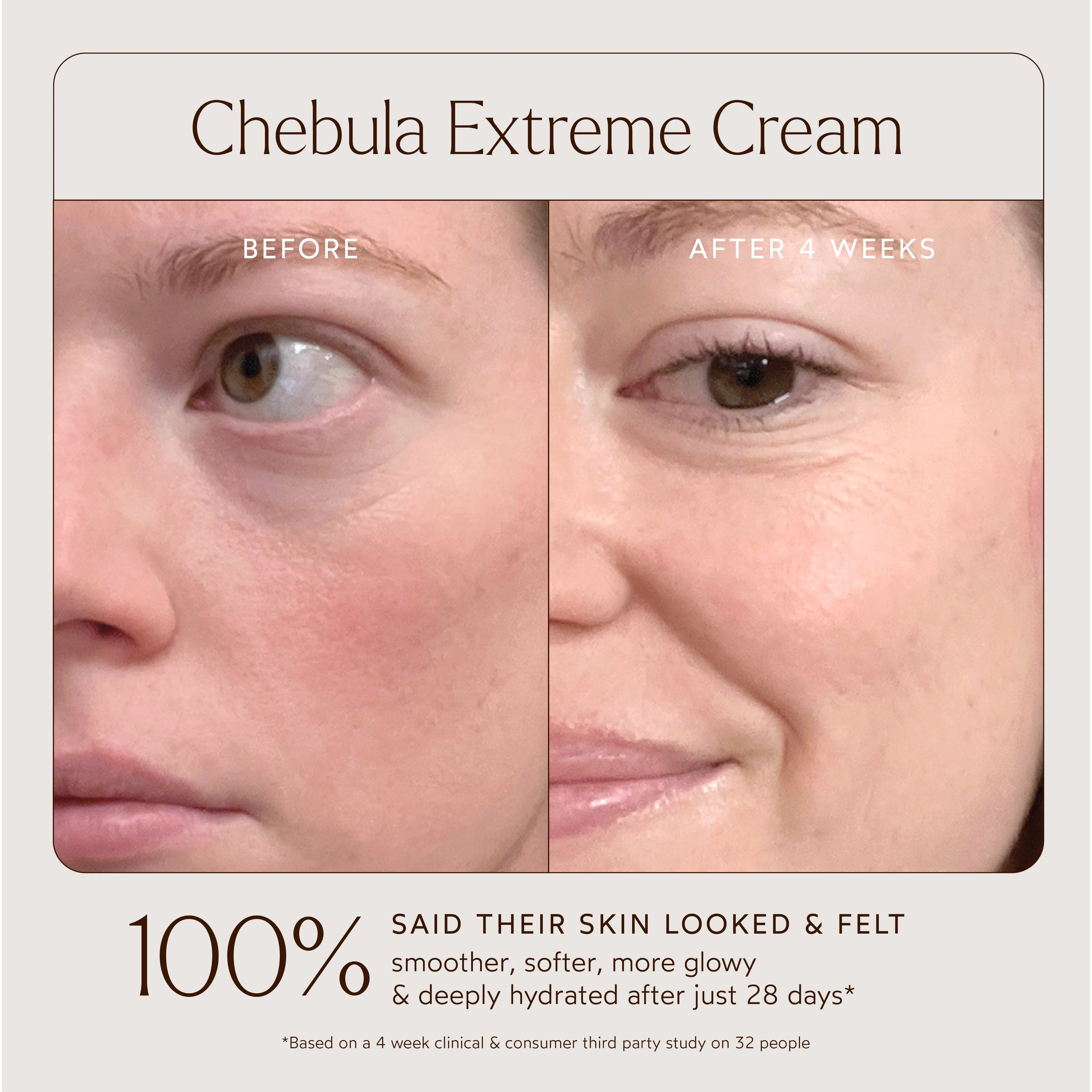 Renew Chebula Extreme Cream - Image 4