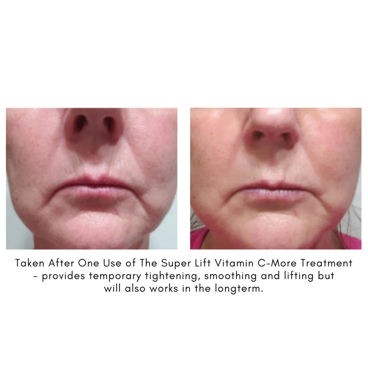 The Super Lift Vitamin C-More Treatment - Image 4