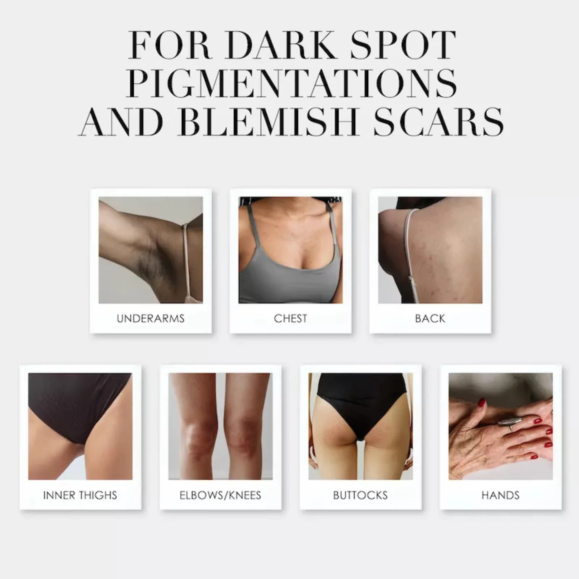 The Takesumi Bright - The Starter Kit for Underarm Dark Spot Pigmentation - Image 5