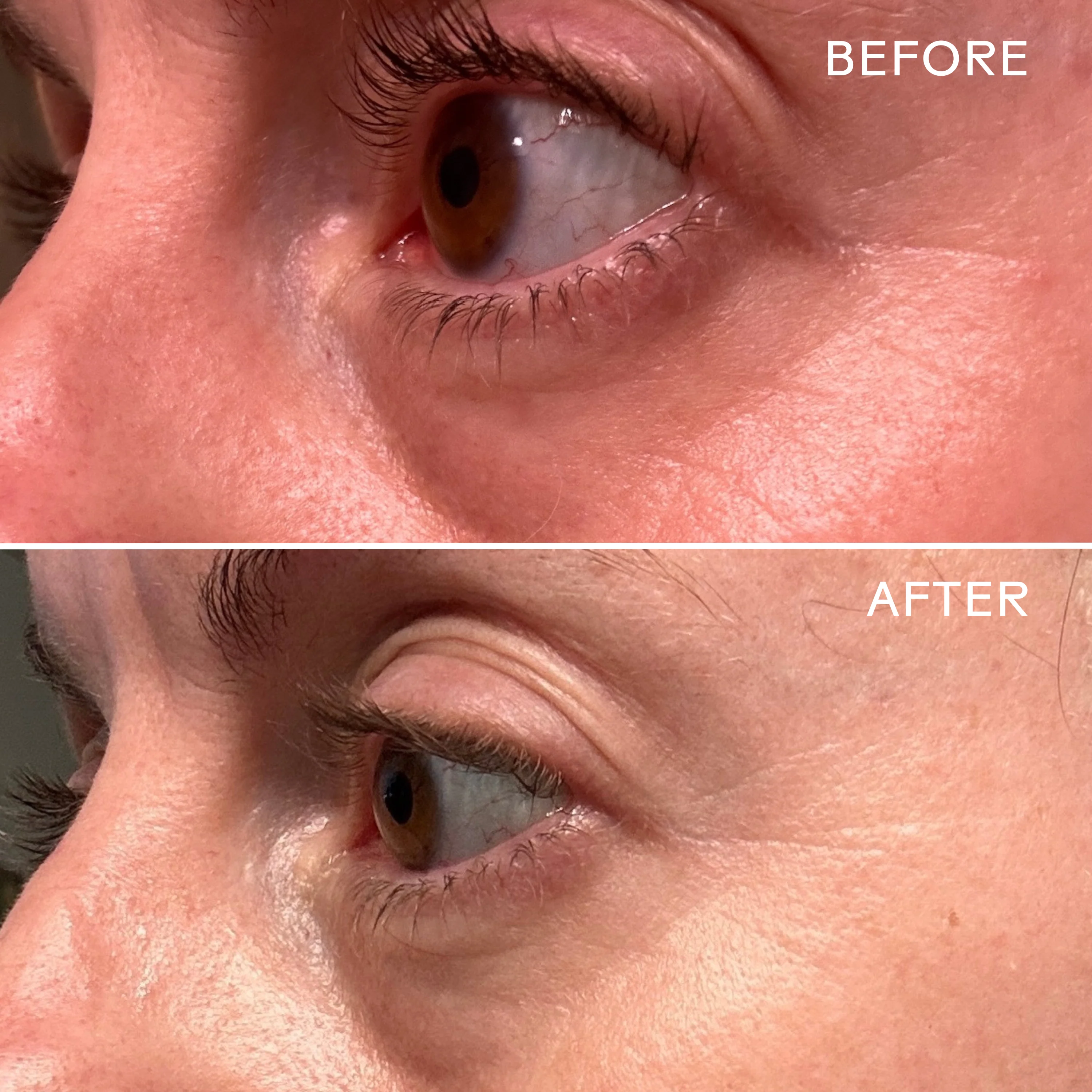 EyeHero™ Bio-Retinol Smoothing Eye Cream - Image 12