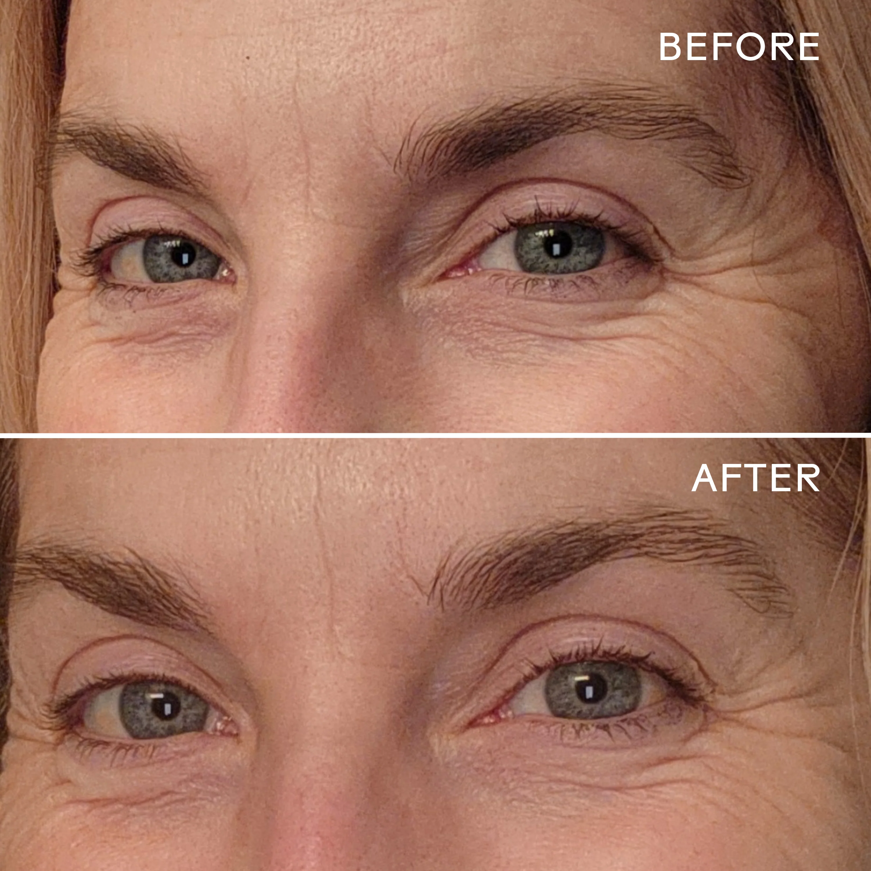 EyeHero™ Bio-Retinol Smoothing Eye Cream - Image 13