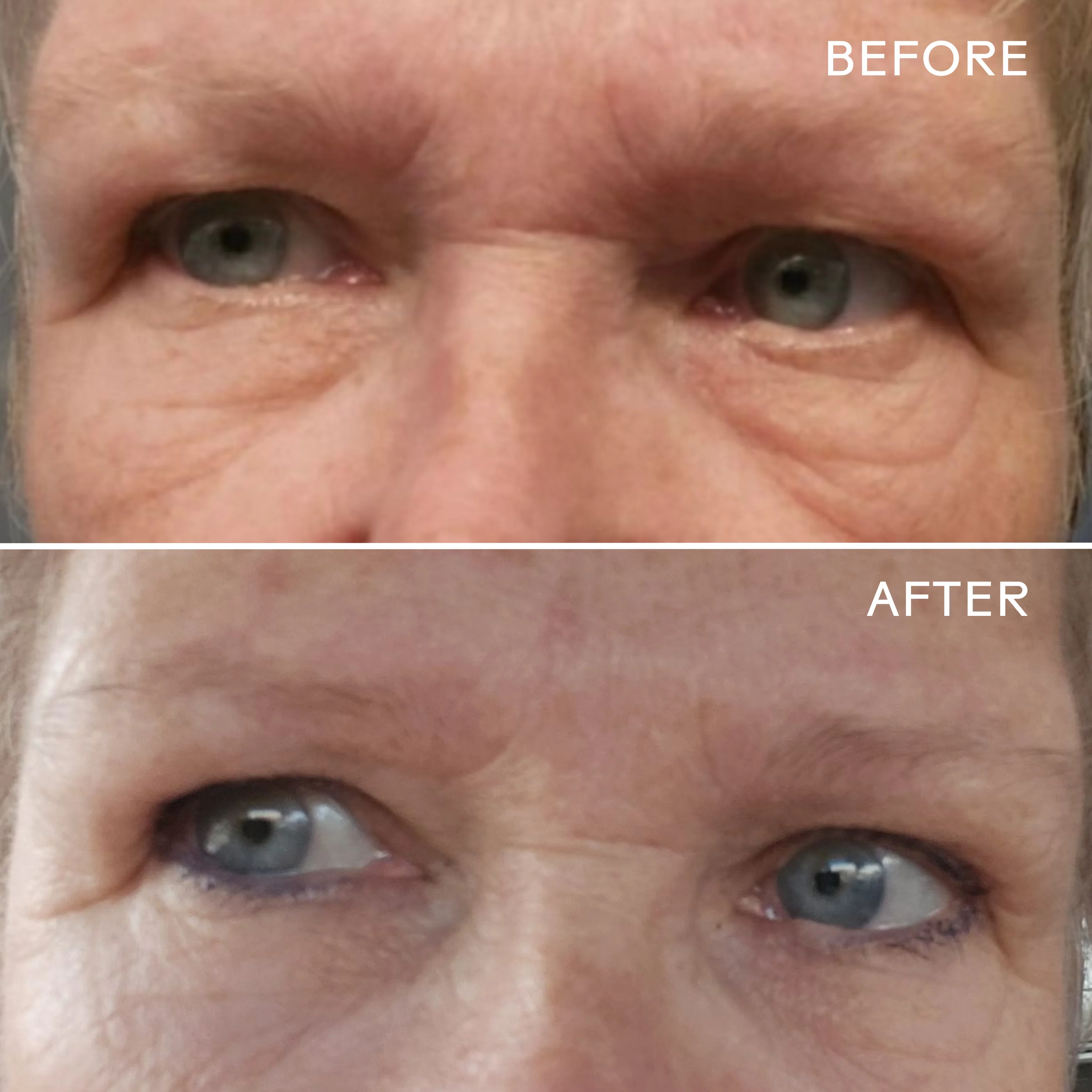 EyeHero™ Bio-Retinol Smoothing Eye Cream - Image 14