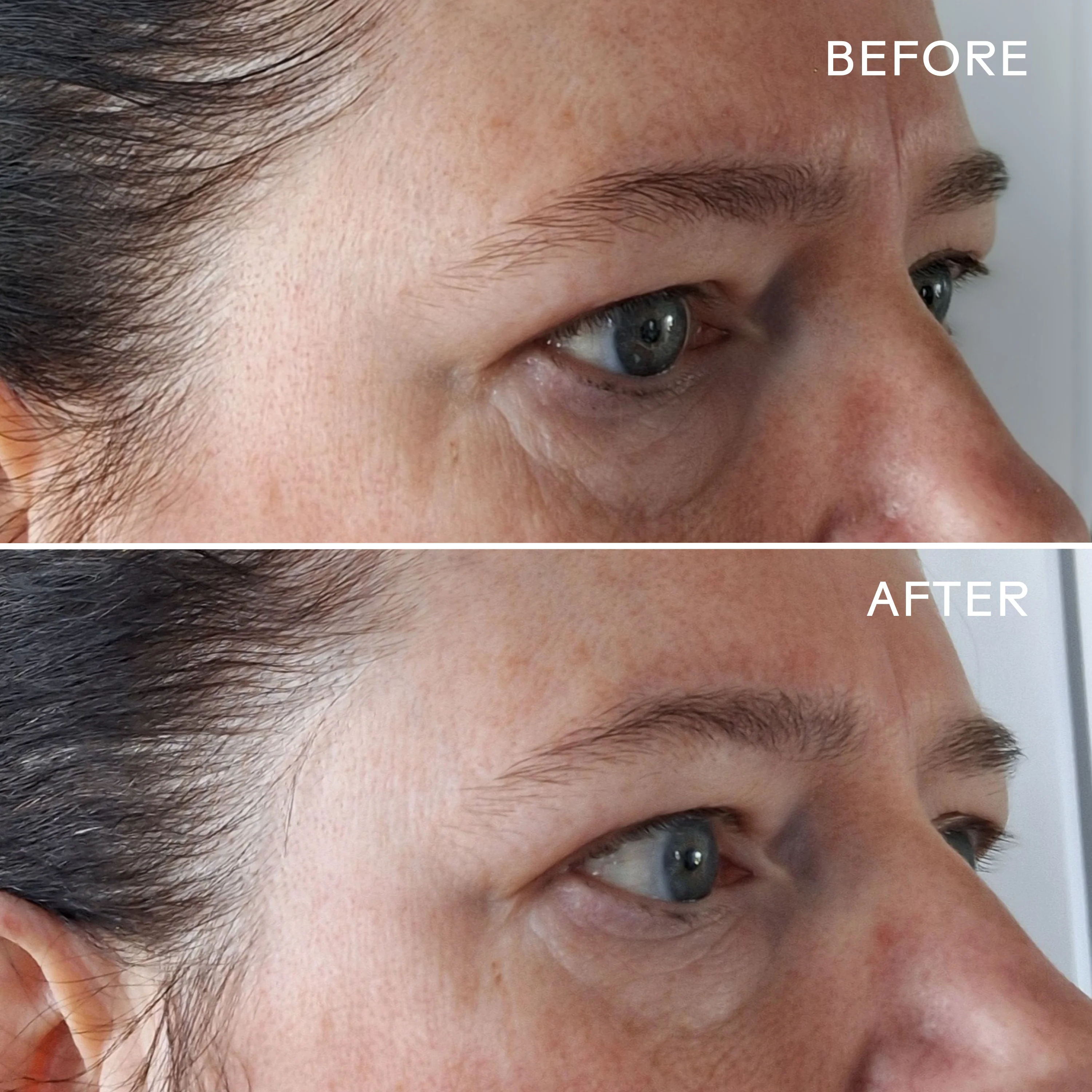 EyeHero™ Bio-Retinol Smoothing Eye Cream - Image 15