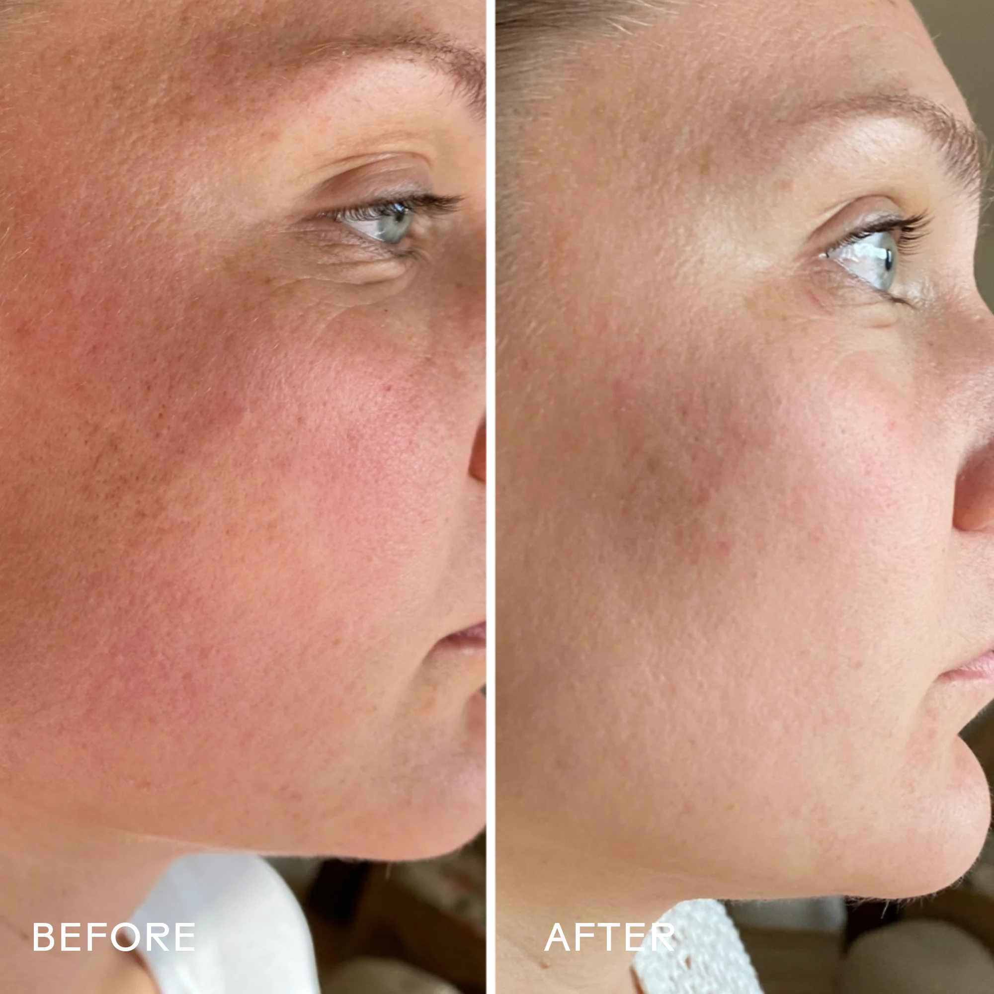 SkinHero™ Calendula + 2% Bakuchiol Bio-Retinol Serum - Image 3
