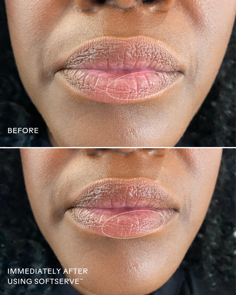 SoftServe™ Pomegranate + Shea Butter Barrier-Building Lip Treatment - Image 8