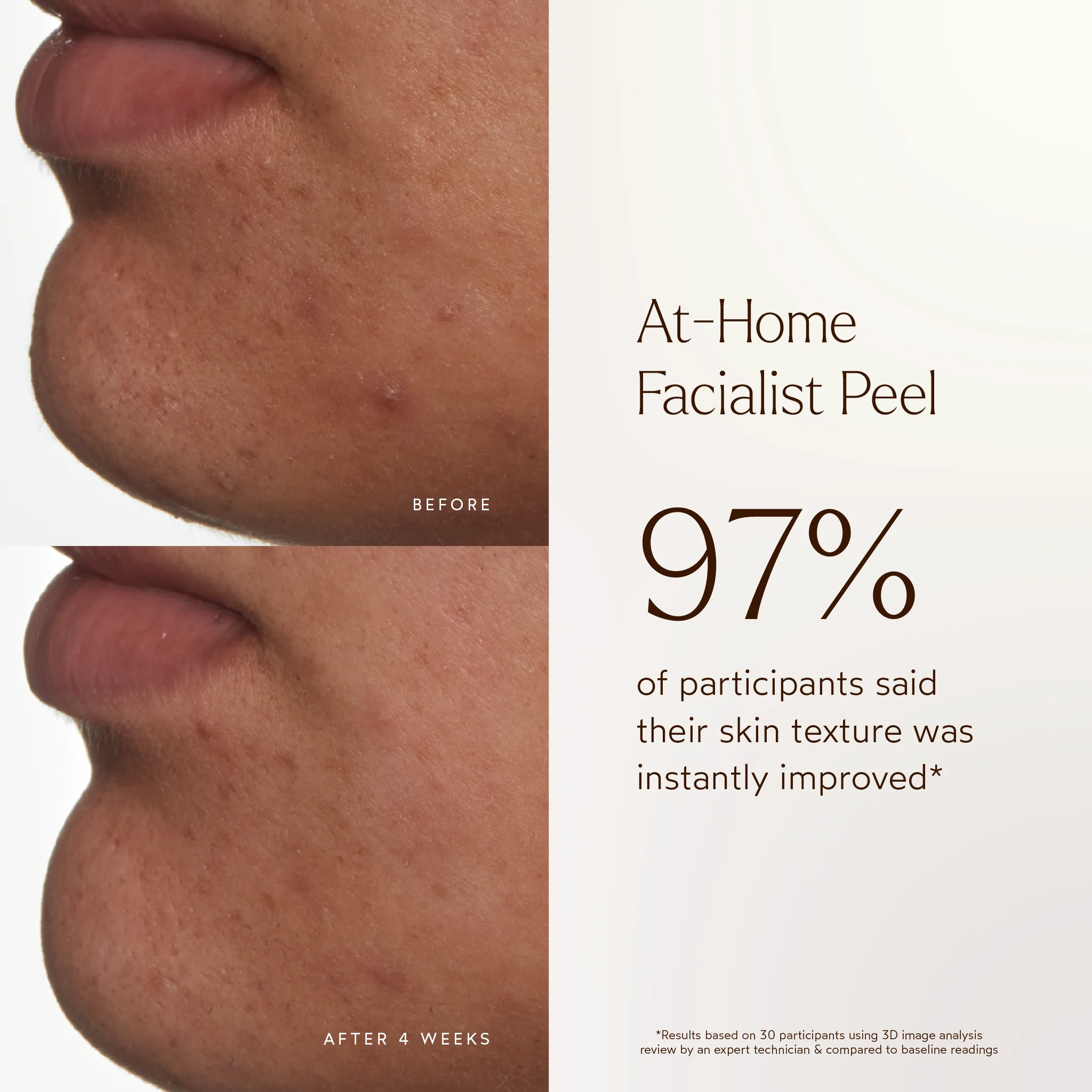 At-Home Facialist Peel - Image 4