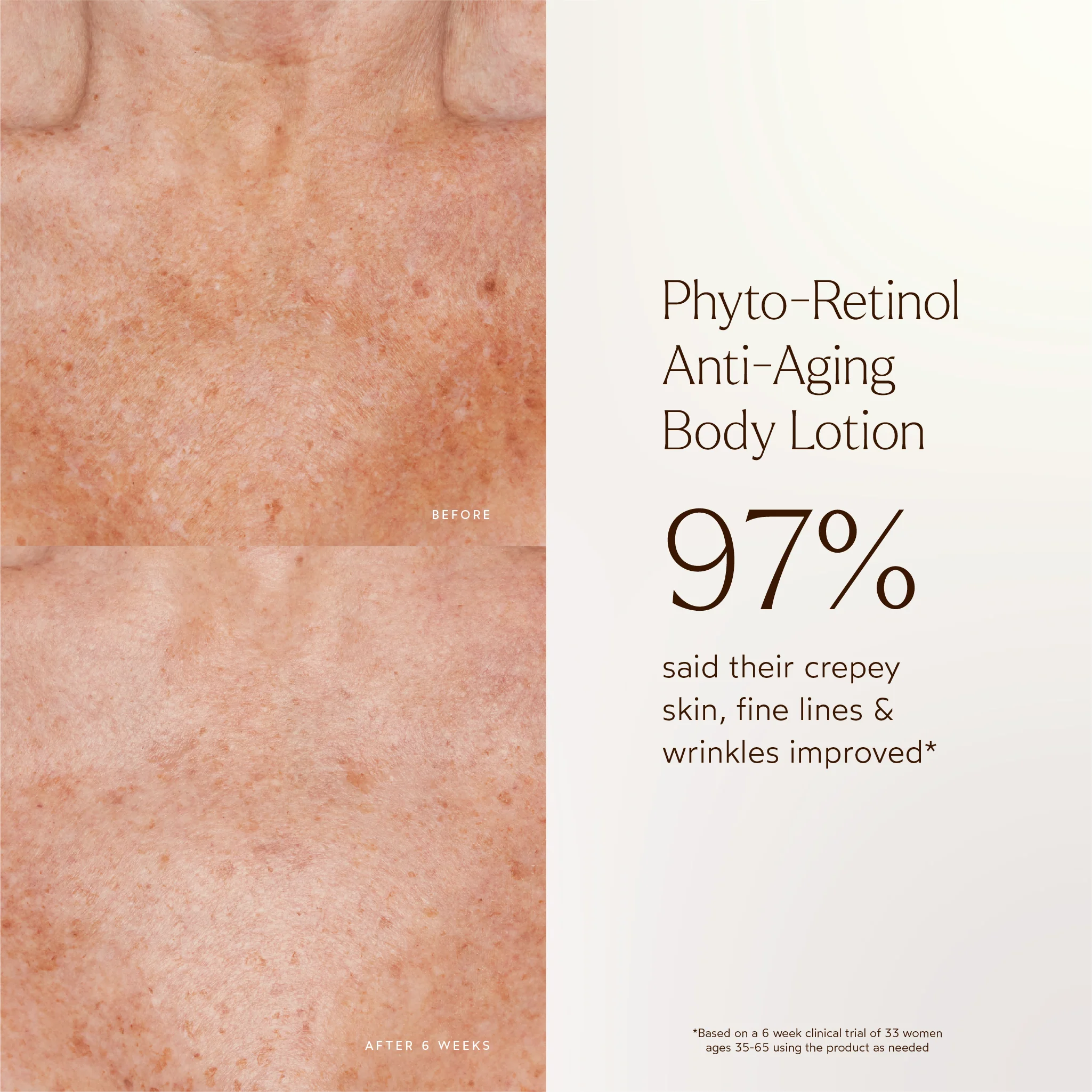 Phyto-Retinol Anti-Aging Body Lotion - Image 6