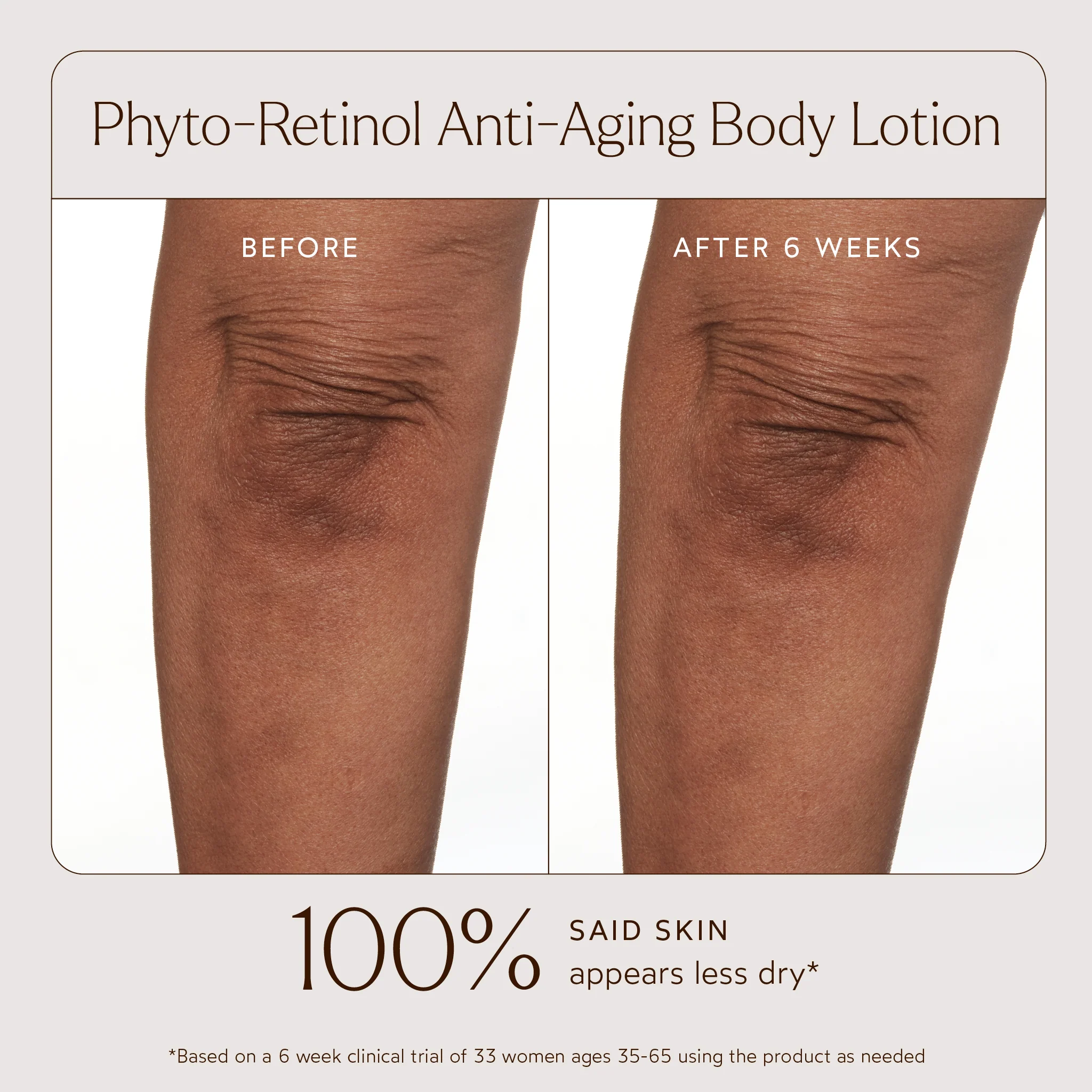 Phyto-Retinol Anti-Aging Body Lotion - Image 9