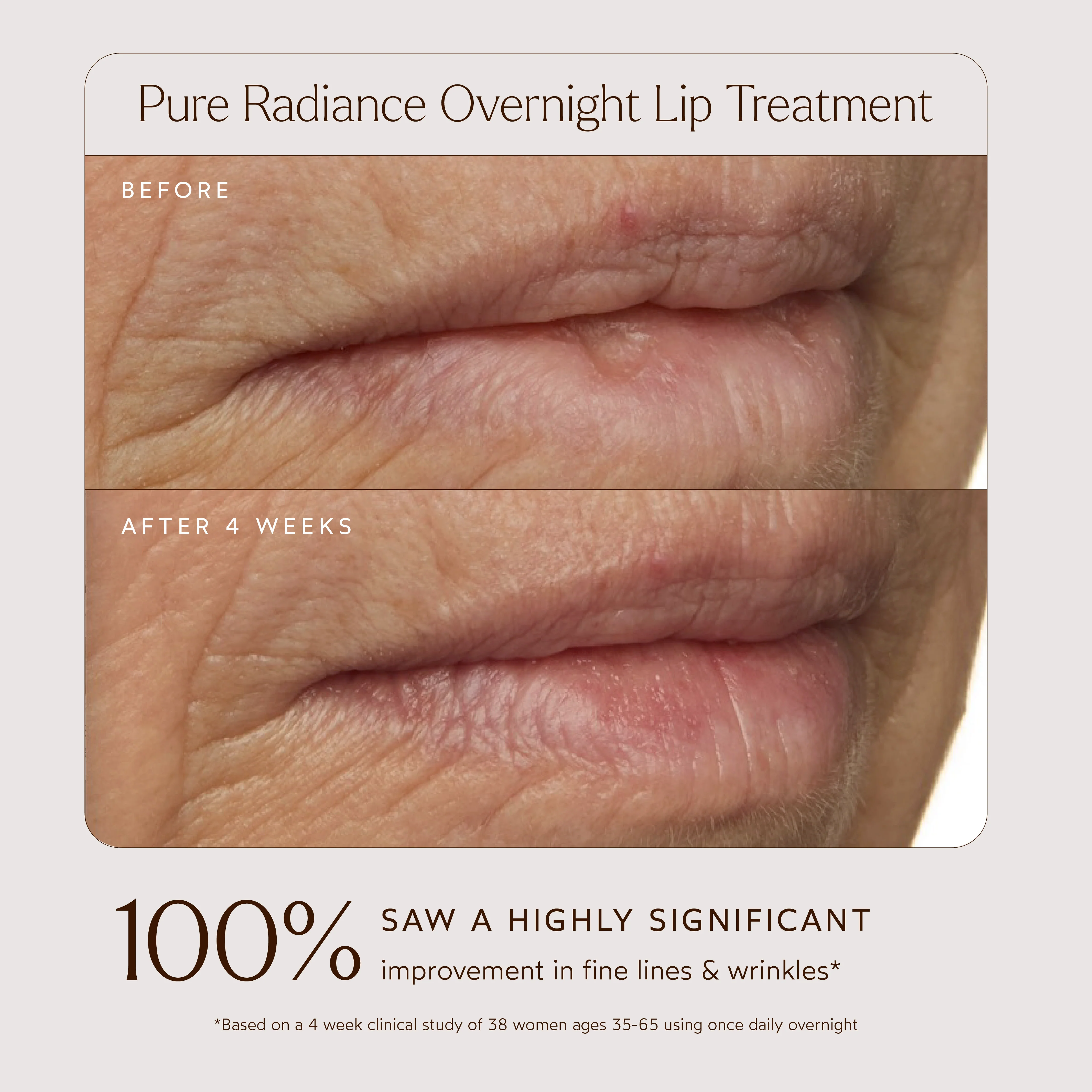 Pure Radiance Overnight Lip Treatment - Image 3