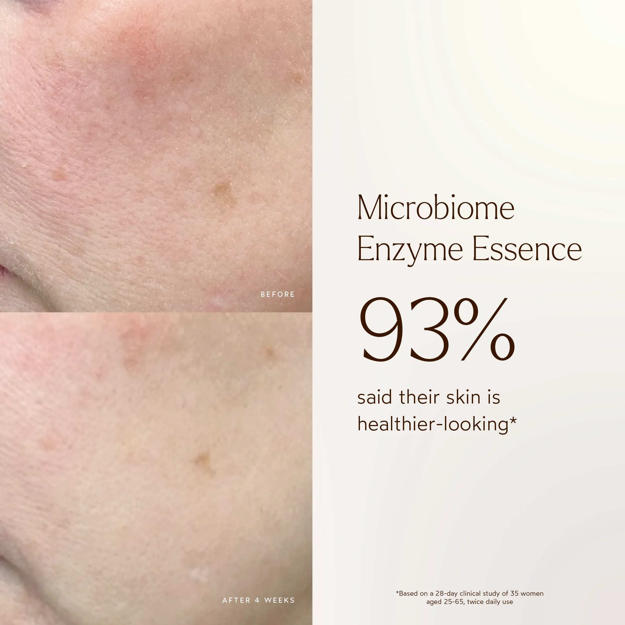 Renew Microbiome Enzyme Essence - Image 6