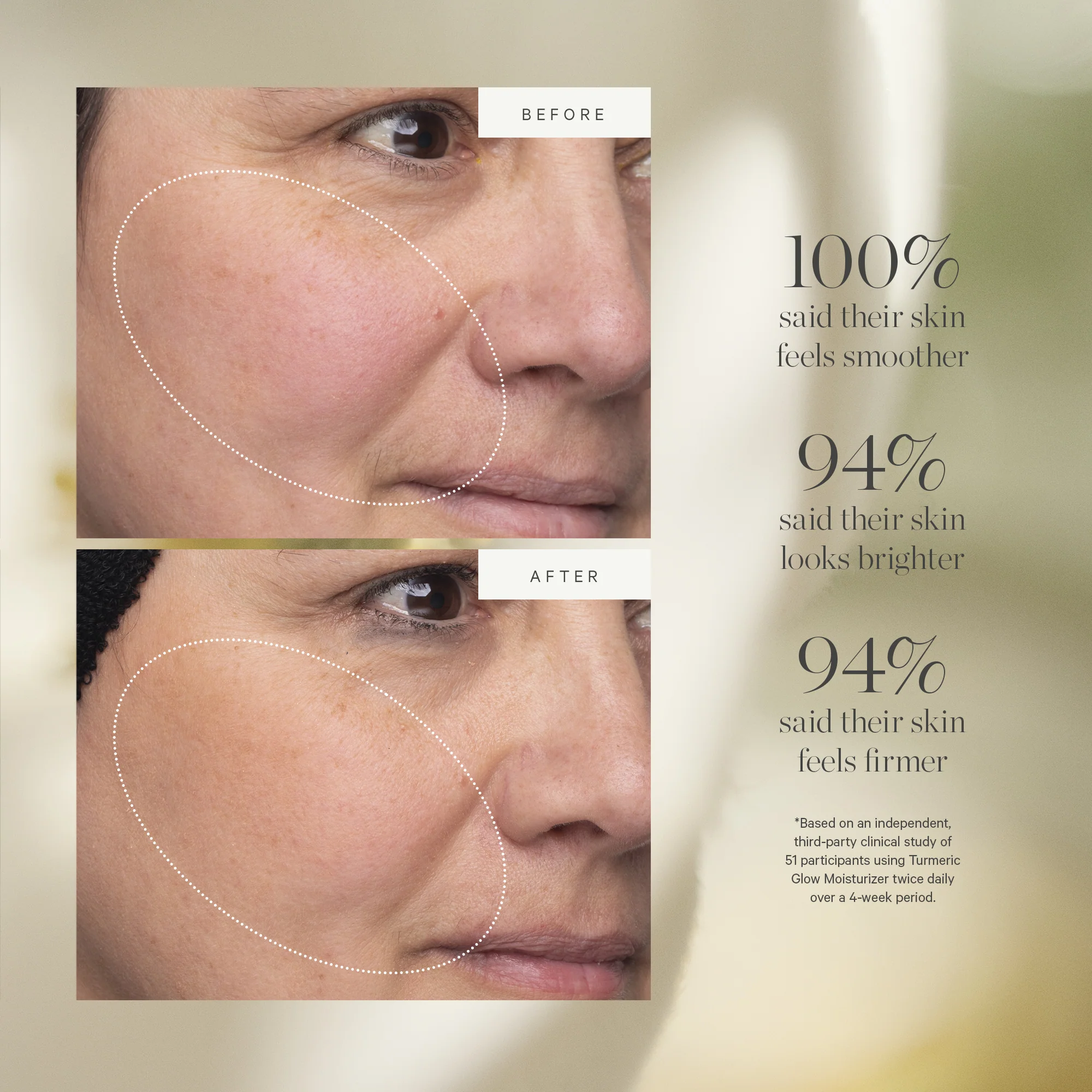 Turmeric Glow Moisturizer - Image 5