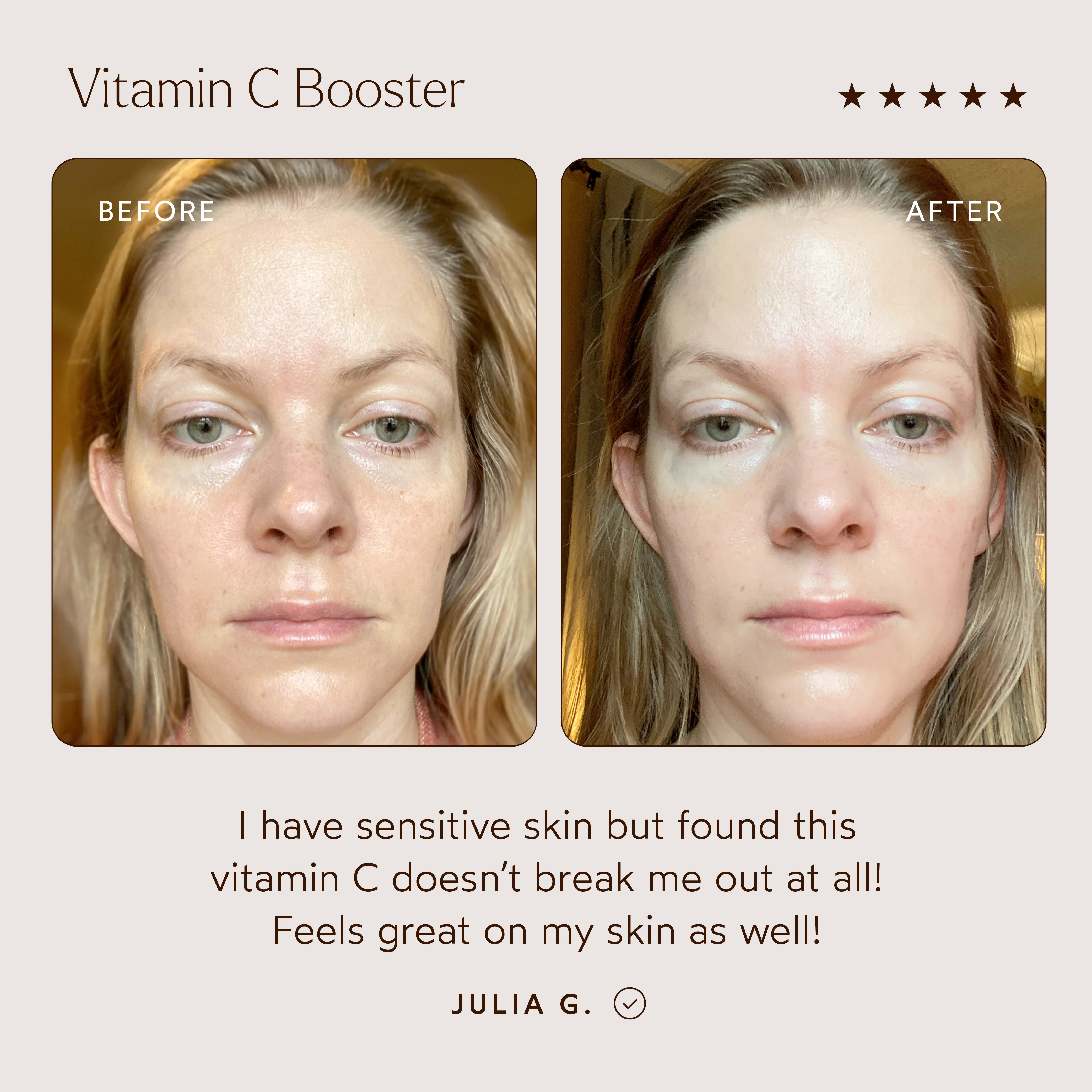 Vitamin C Booster - Image 3